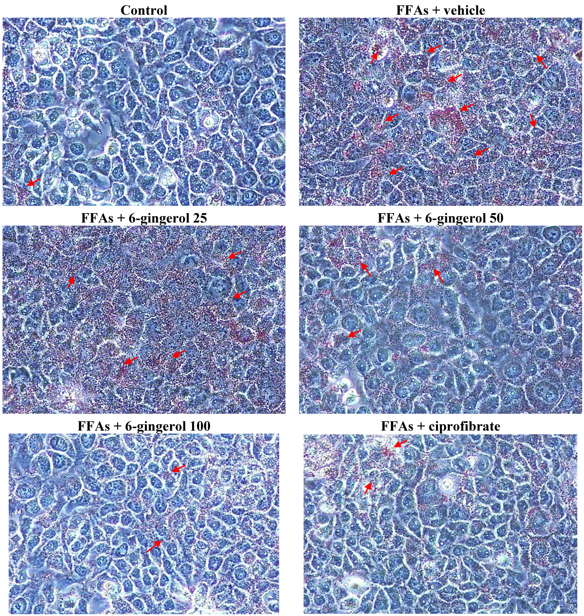 Nutrients Free Full Text 6 Gingerol Protects Against Nutritional Steatohepatitis By Regulating Key Genes Related To Inflammation And Lipid Metabolism Html
