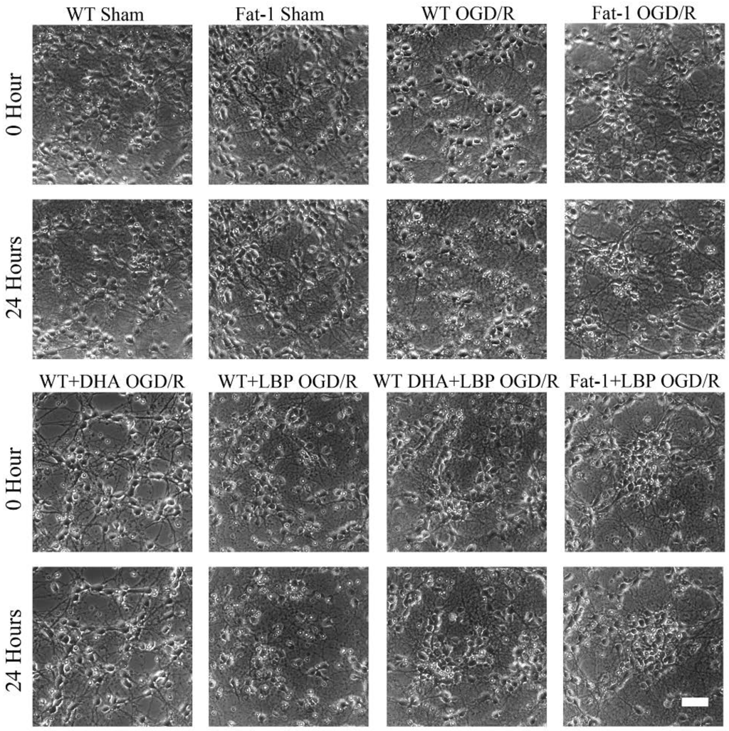Nutrients 08 00041 g002 1024