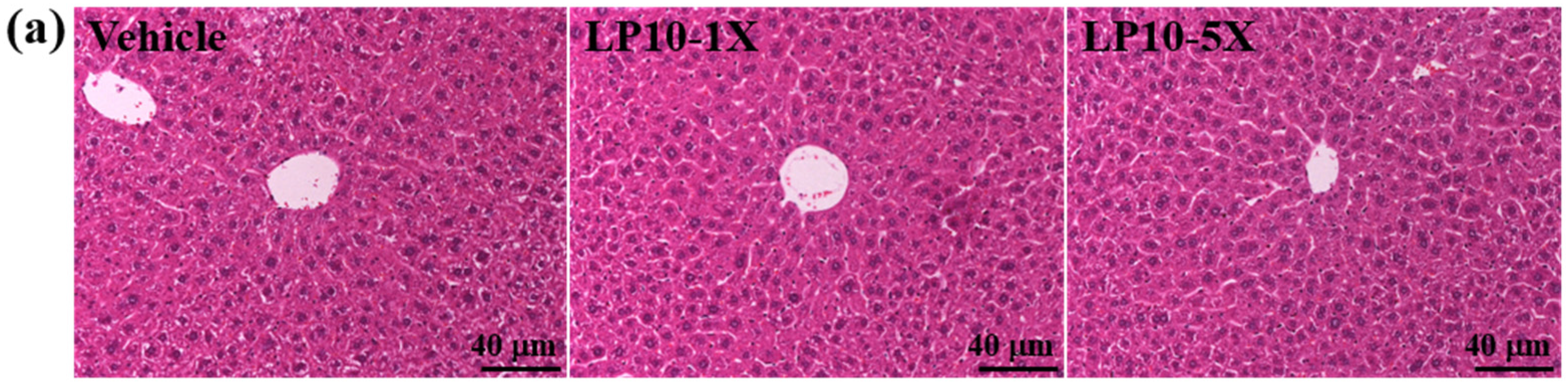 Nutrients 08 00205 g005a