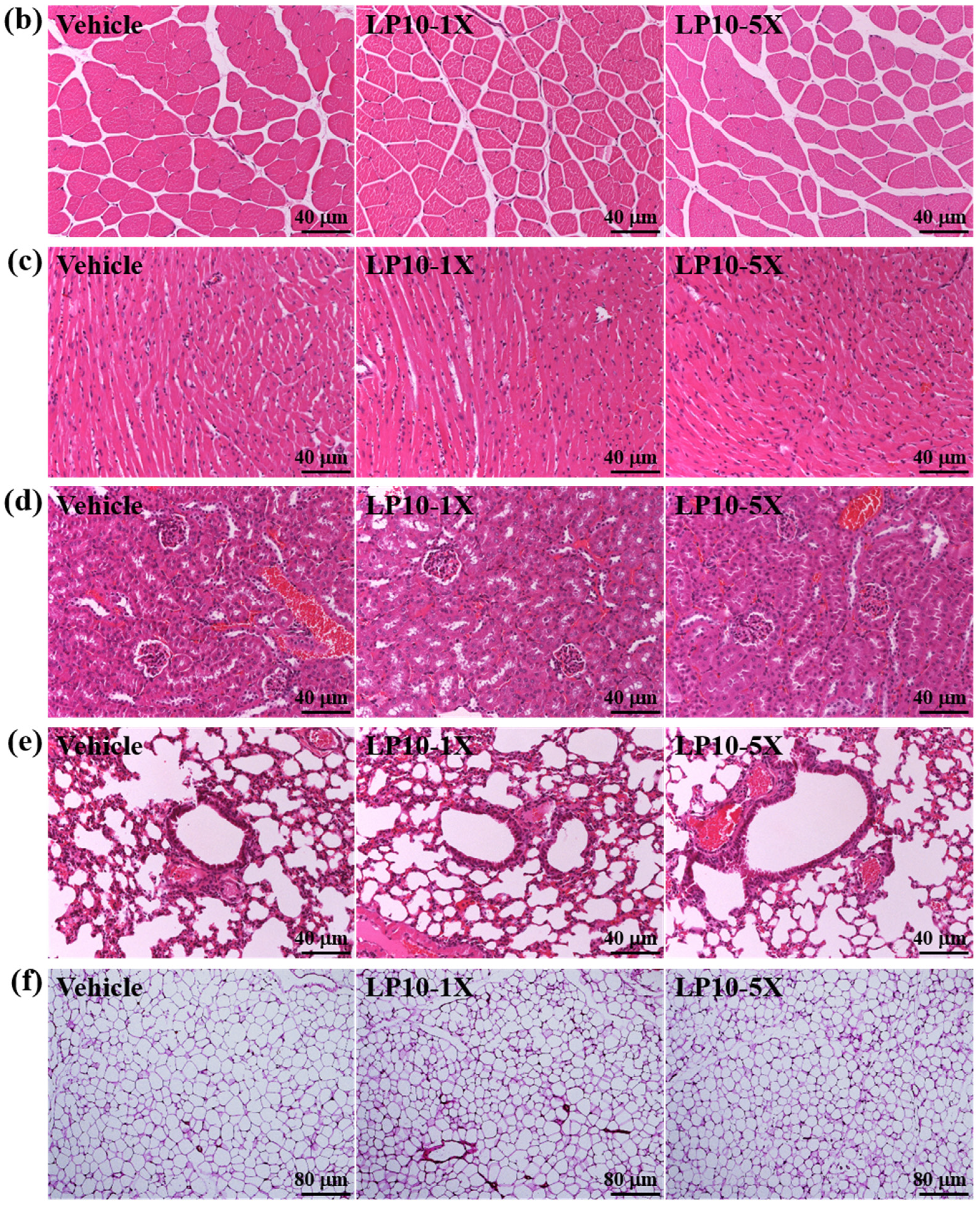 Nutrients 08 00205 g005b
