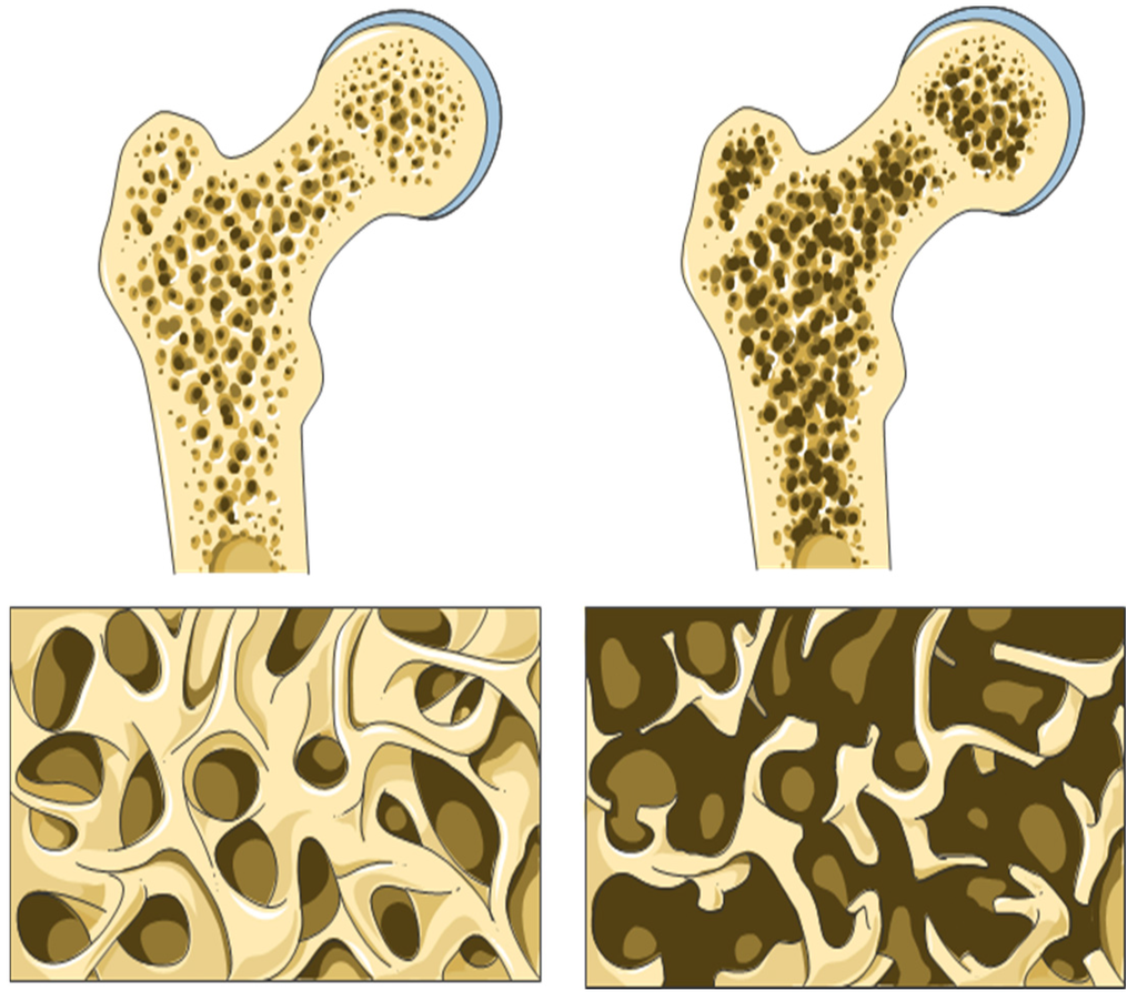Nutrients Free FullText Crucial Role of Vitamin D in the
