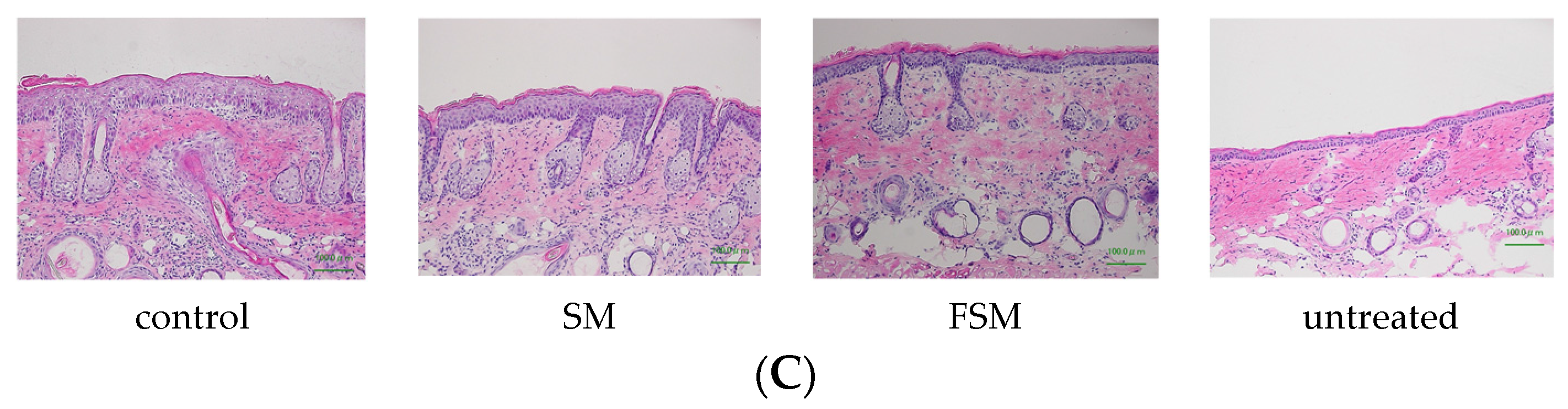 Nutrients 08 00514 g004b 1024