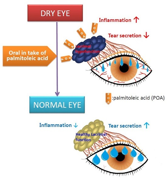 Nutrients Free FullText Restoration of Tear Secretion in a Murine Dry Eye Model by Oral