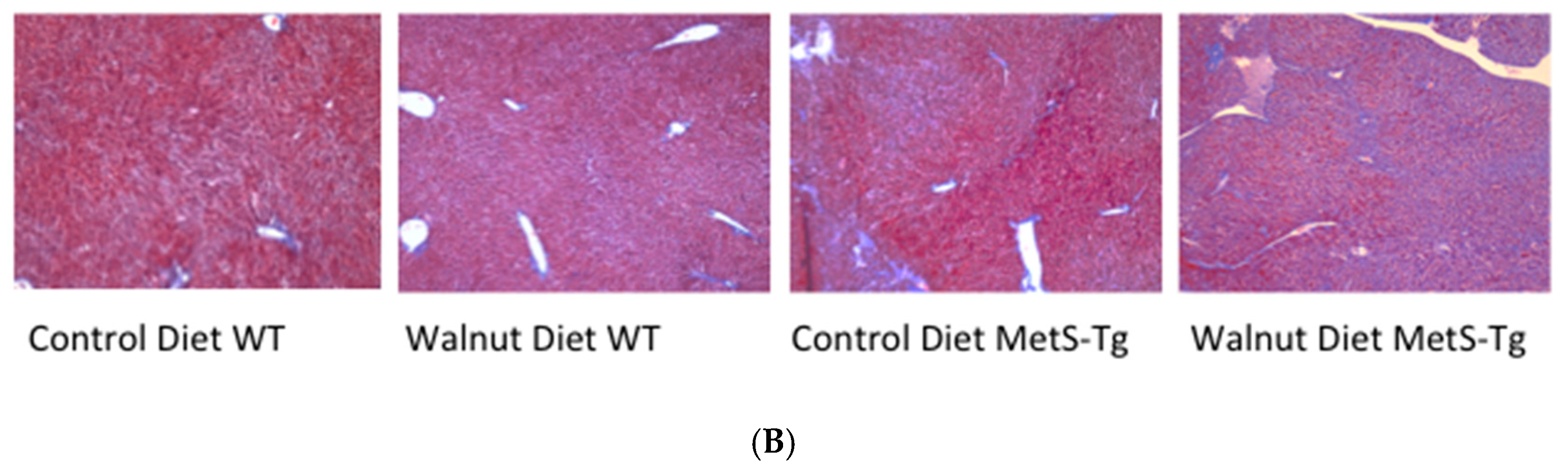 Nutrients 09 00722 g002b 550