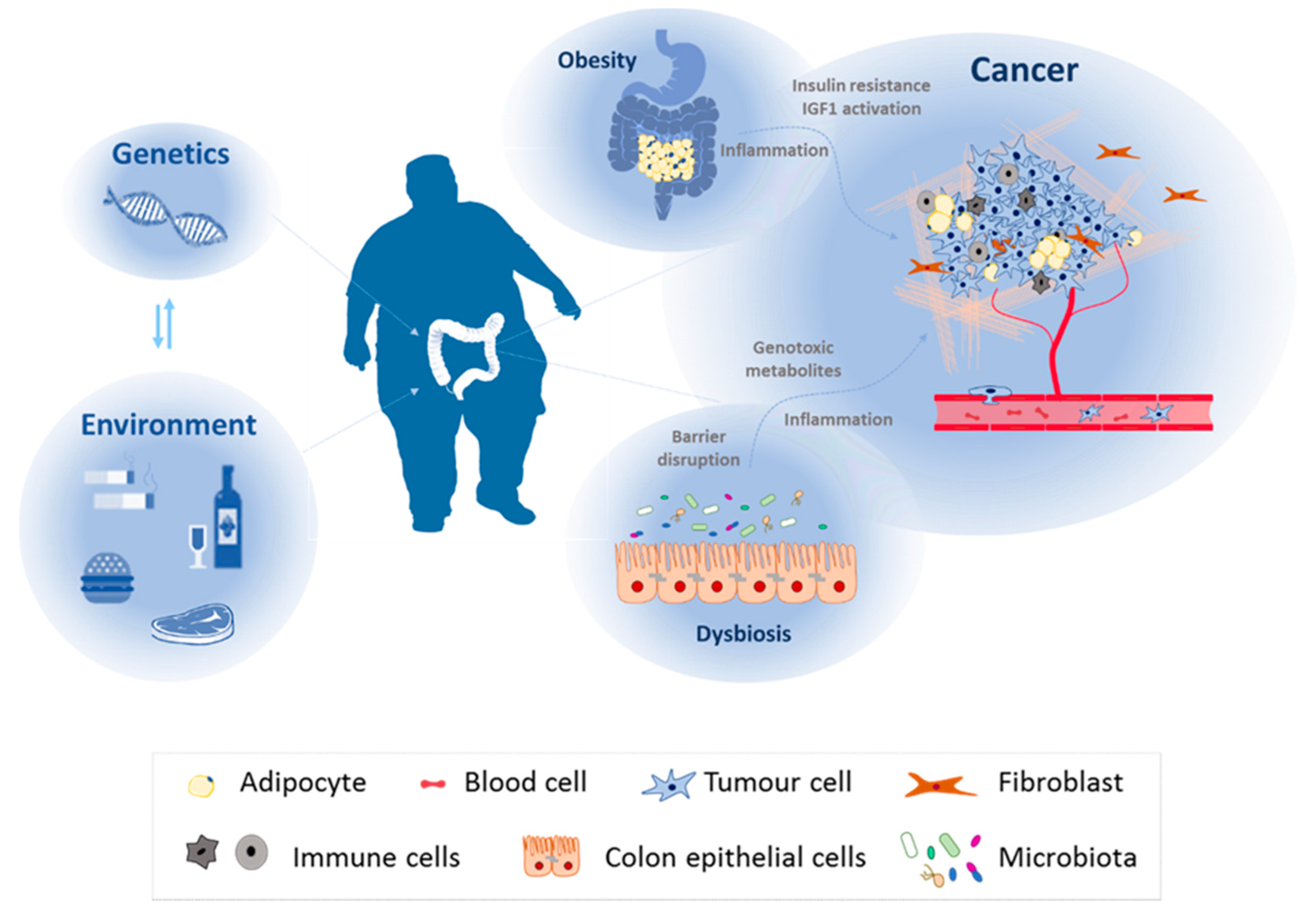 colorectal cancer and nutrition