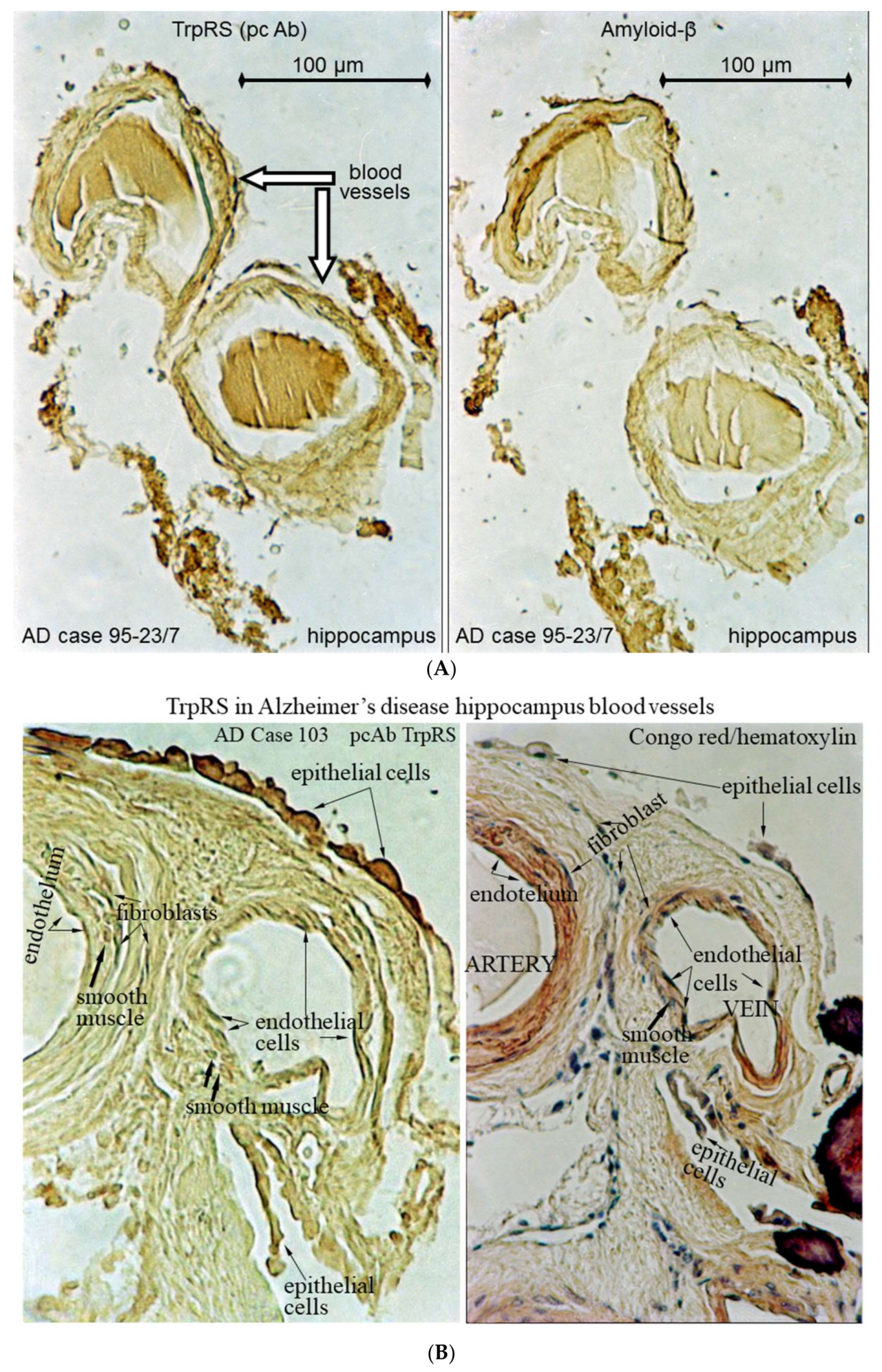 Nutrients 10 00410 g002a Nutrients 10 00410 g002a
