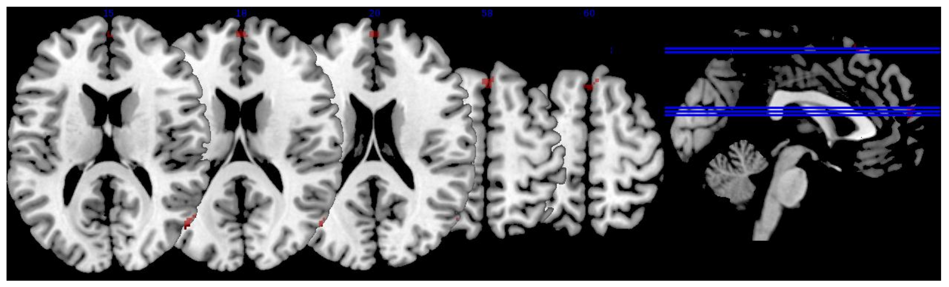 Nutrients 10 00458 g003 Nutrients 10 00458 g003