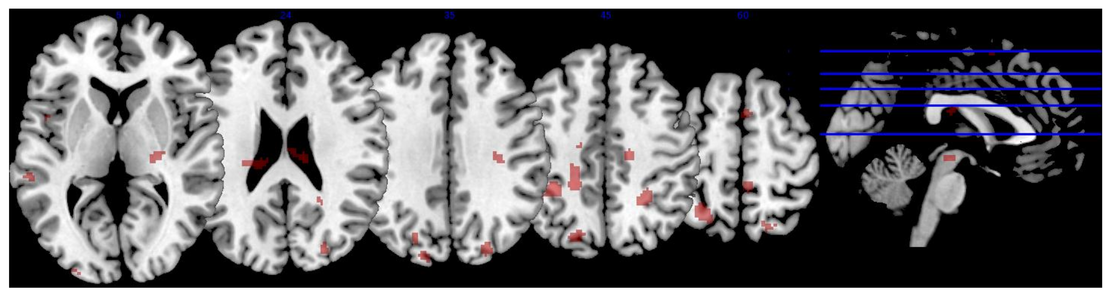 Nutrients 10 00458 g004 Nutrients 10 00458 g004