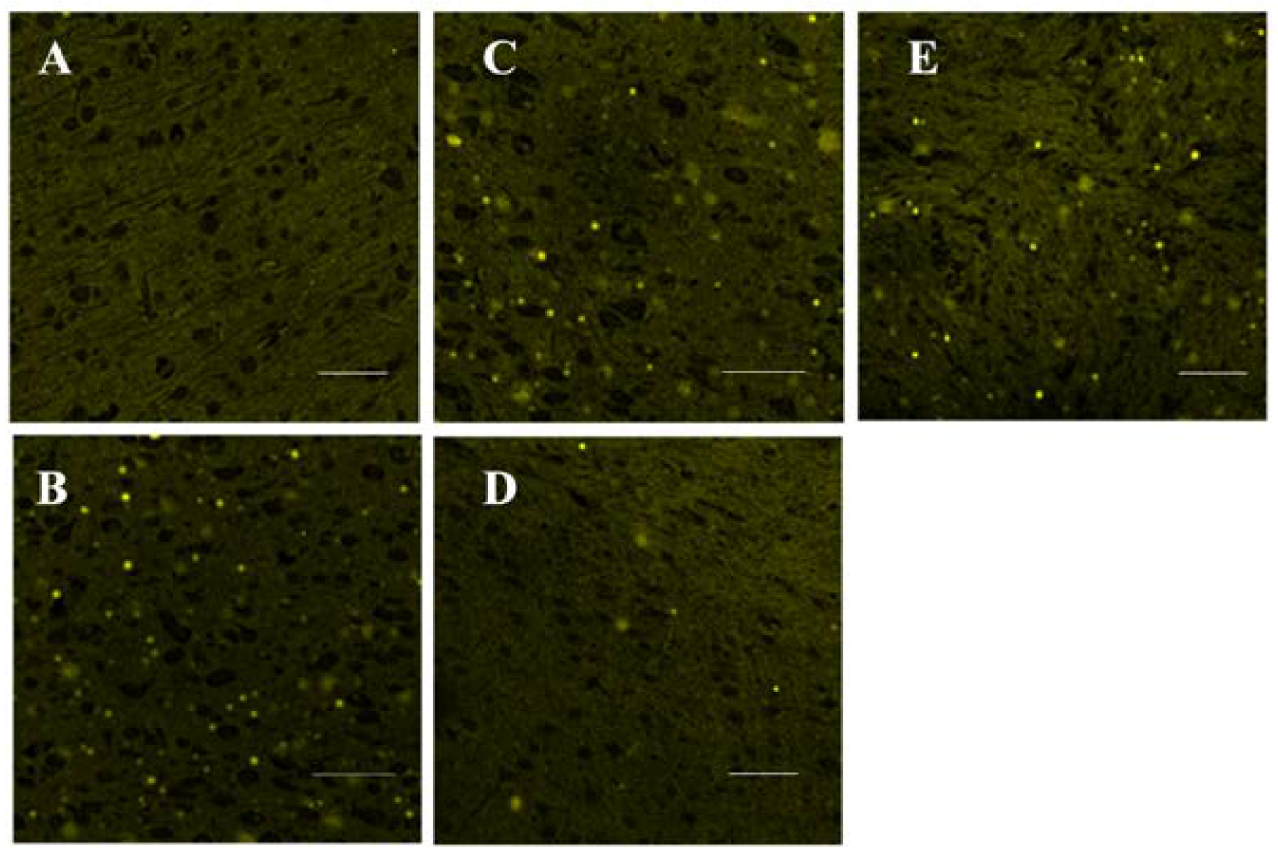 Nutrients 10 00514 g004