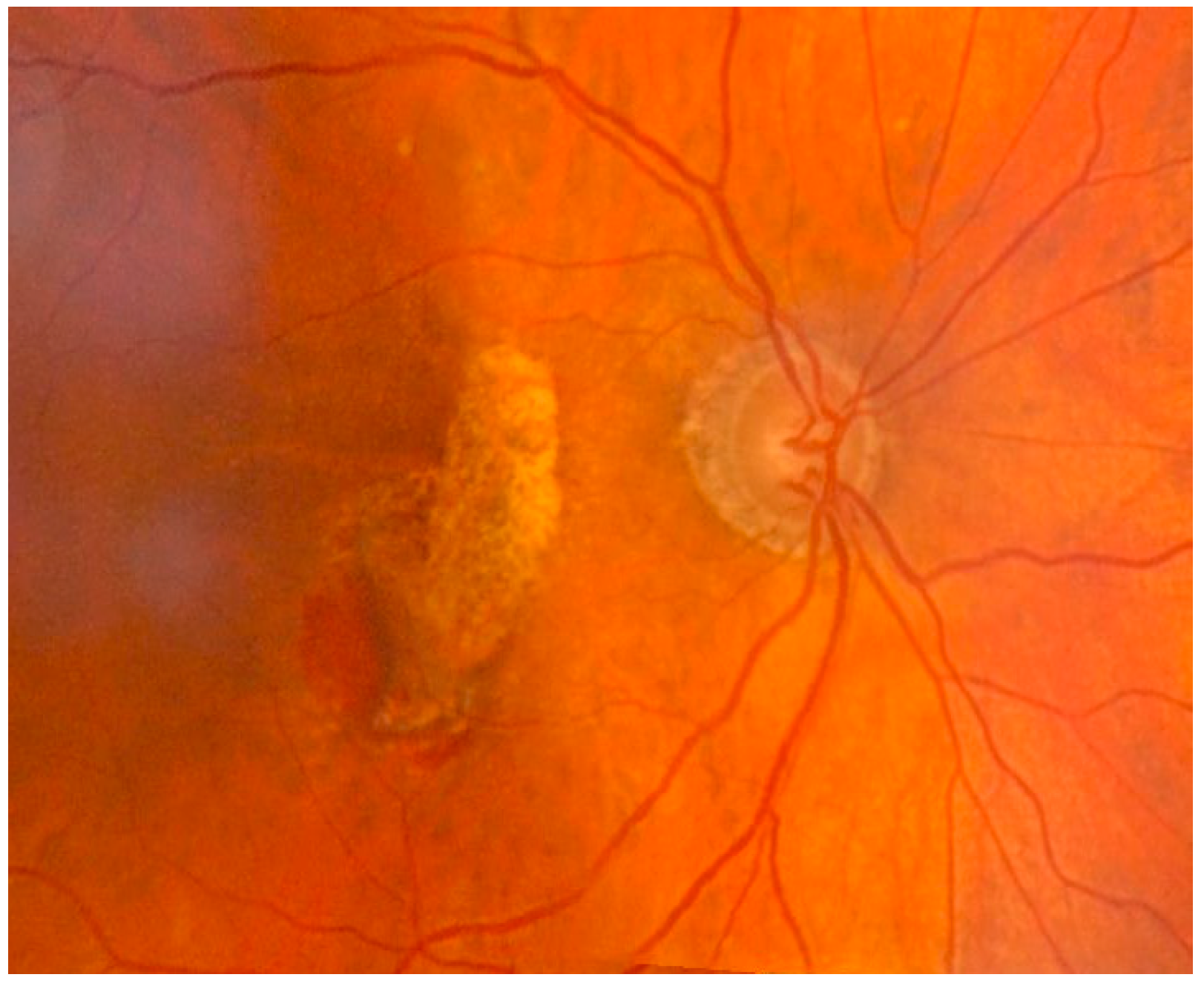 Nutrients 10 00668 g005