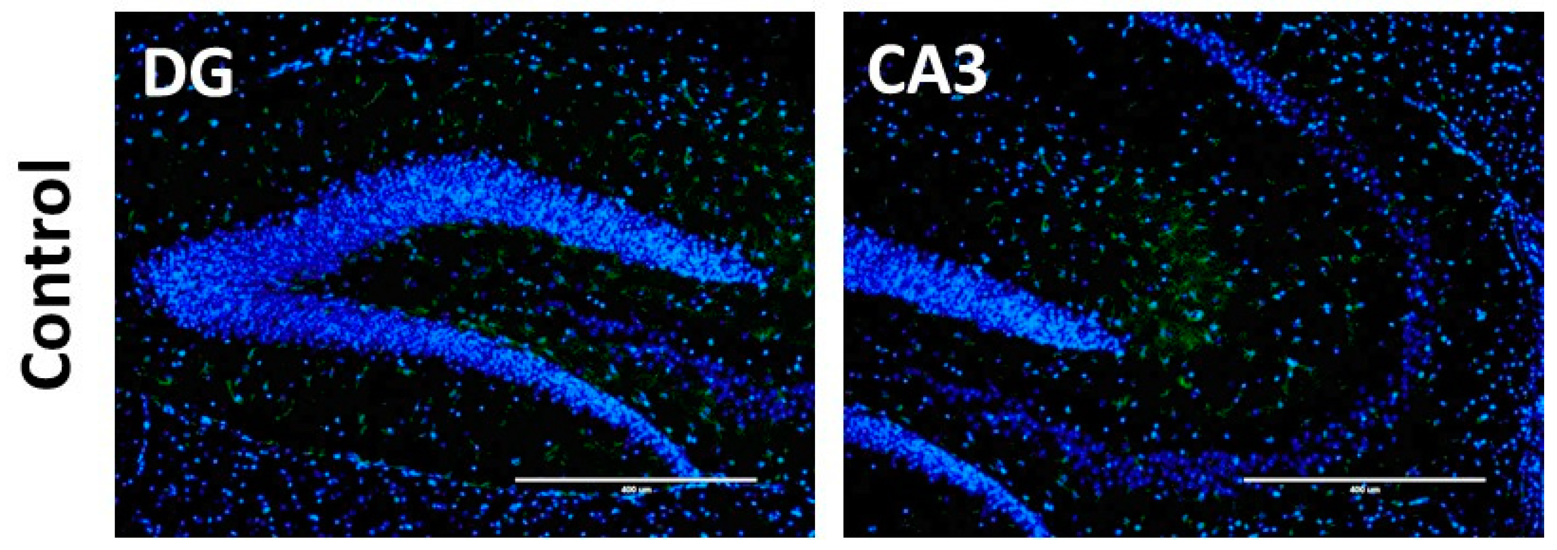 Nutrients 10 00762 g006a Nutrients 10 00762 g006a