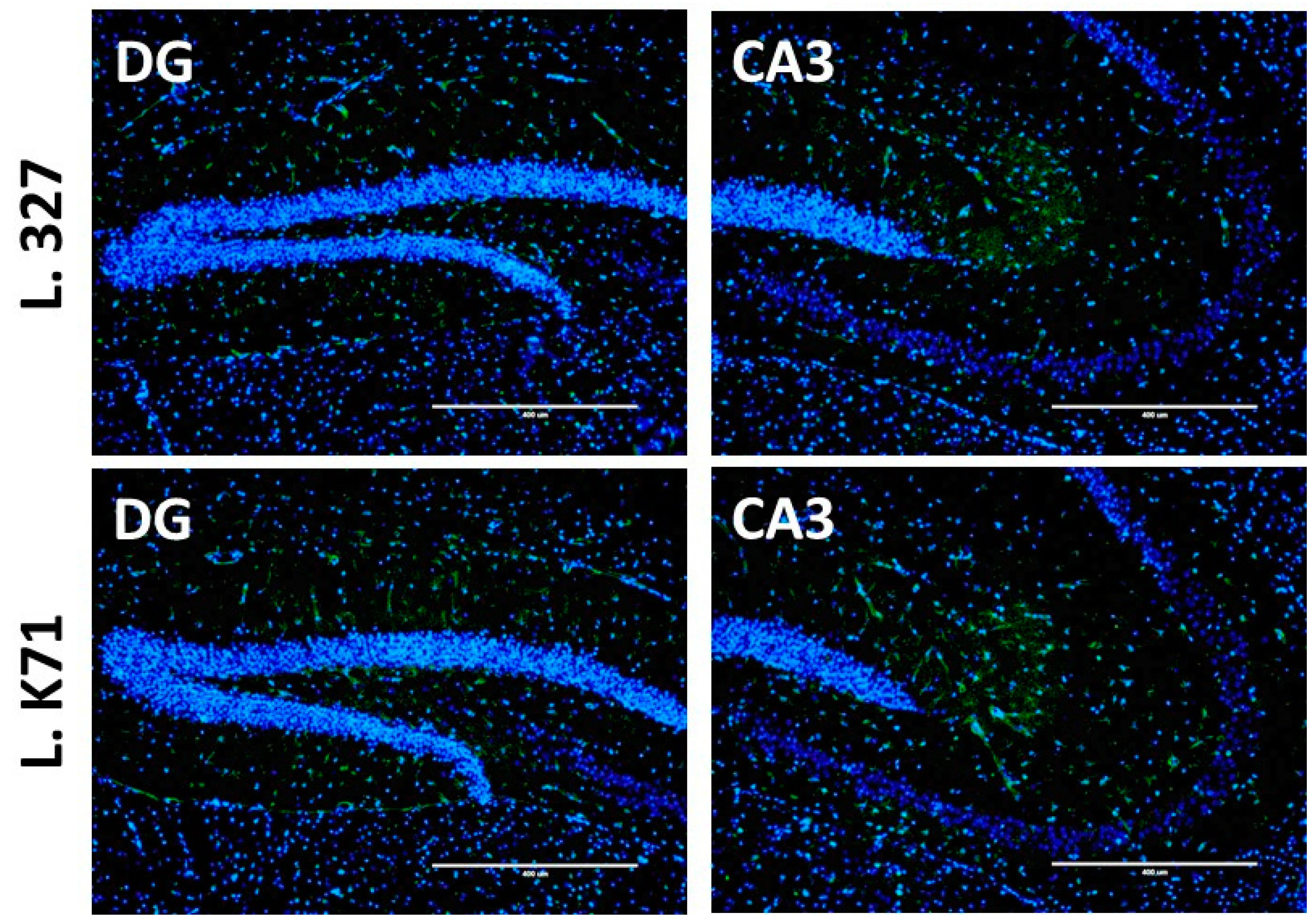 Nutrients 10 00762 g006b Nutrients 10 00762 g006b