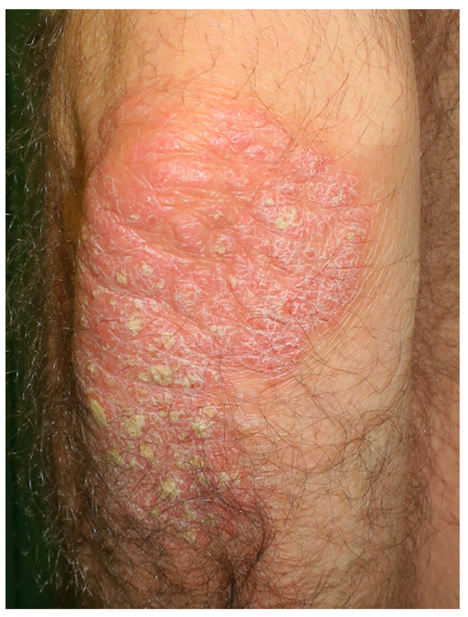 Nutrients 10 00800 g003