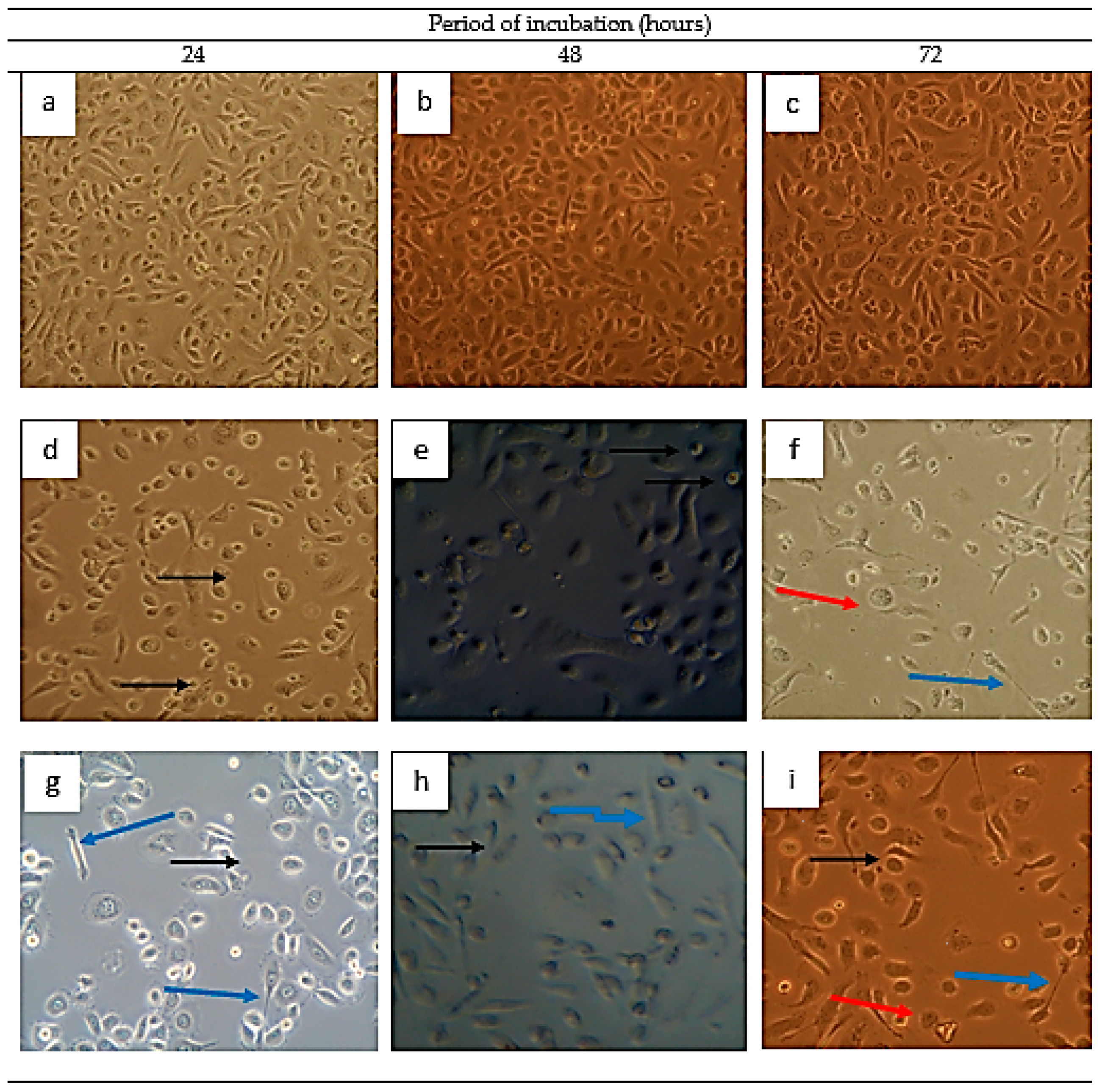 Nutrients Free Full Text Nontoxic Glucomoringin Isothiocyanate Gmg Itc Rich Soluble Extract Induces Apoptosis And Inhibits Proliferation Of Human Prostate Adenocarcinoma Cells Pc 3 Html