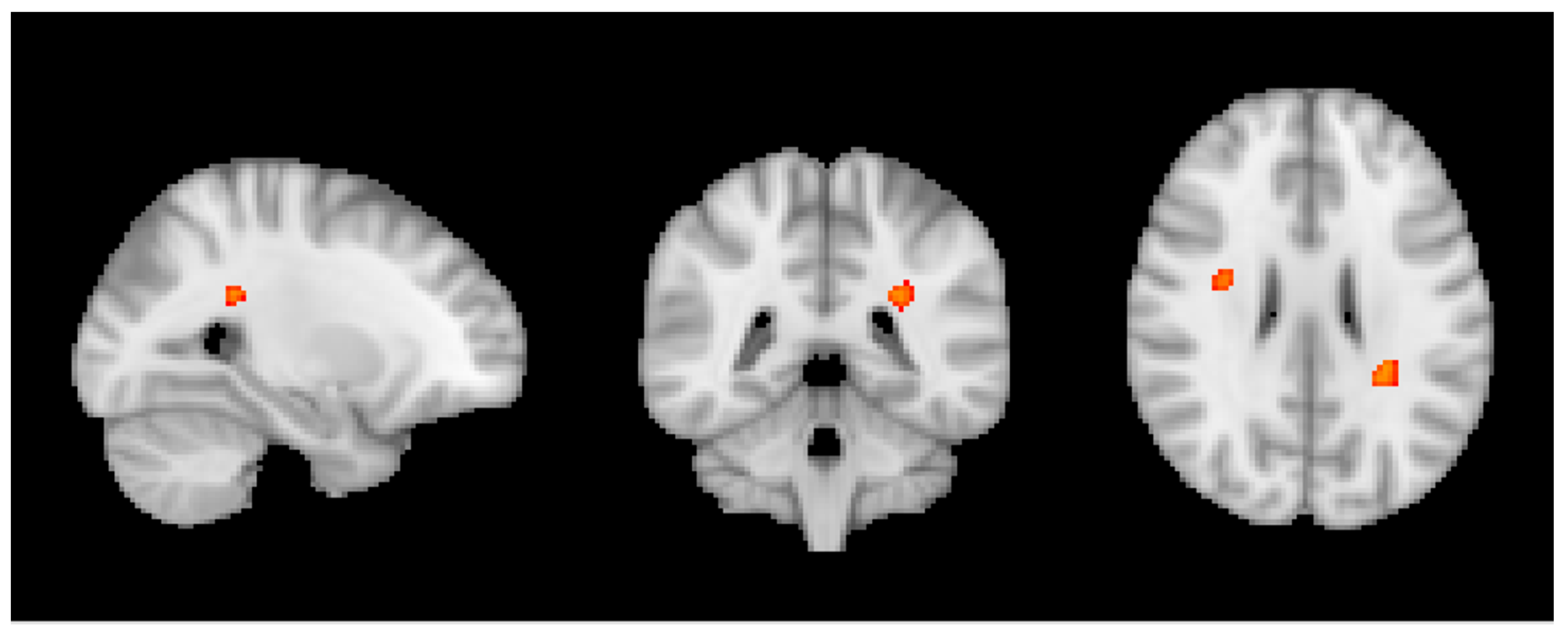 Nutrients 10 01391 g003 Nutrients 10 01391 g003