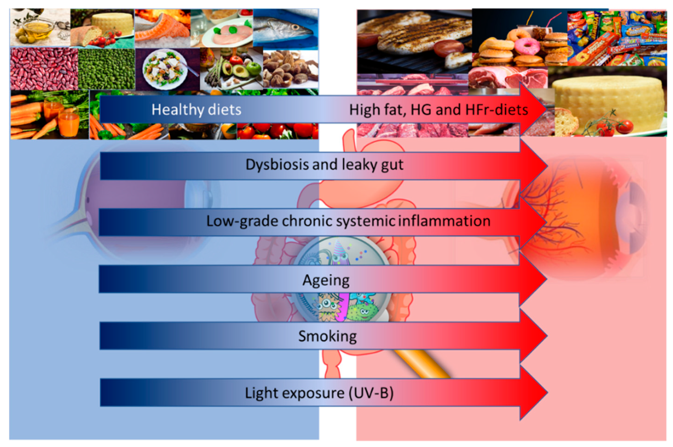 Nutrients Free Full Text The Role Of Diet Micronutrients And The Gut Microbiota In Age Related Macular Degeneration New Perspectives From The Gut Retina Axis Html Nutrients Free Full Text The Role Of Diet Micronutrients And The Gut Microbiota In Age Related Macular Degeneration New Perspectives From The Gut Retina Axis Html