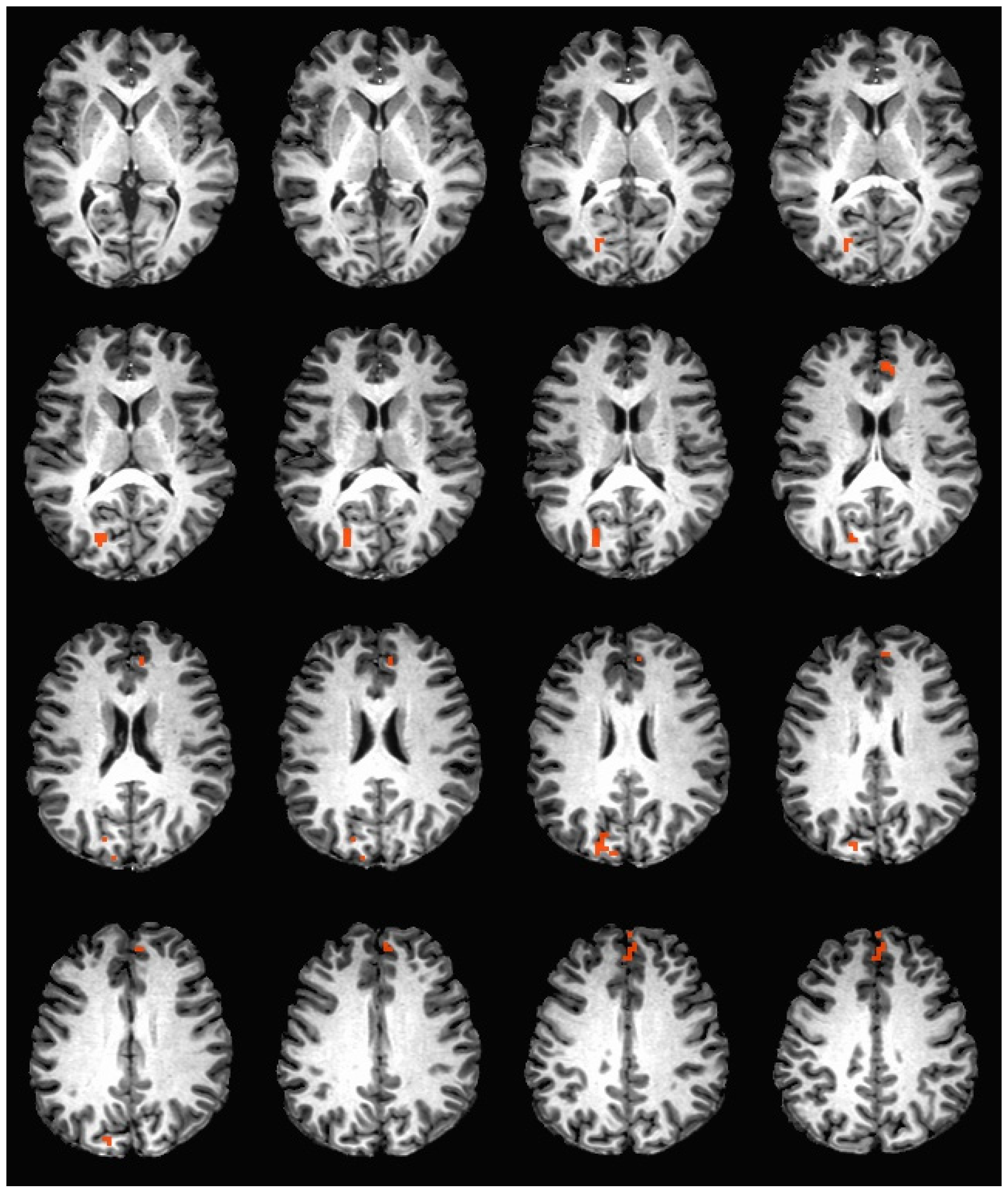 Nutrients 11 00034 g002