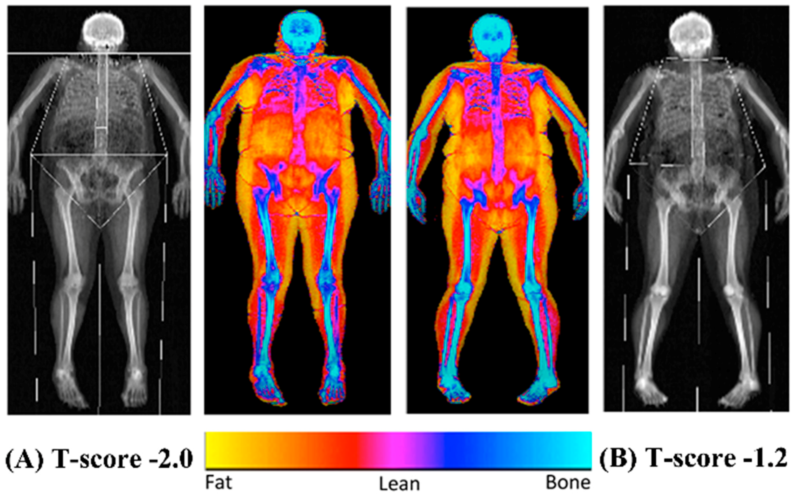 BMI or Body Fat Percentage - Which Should I Focus On? 