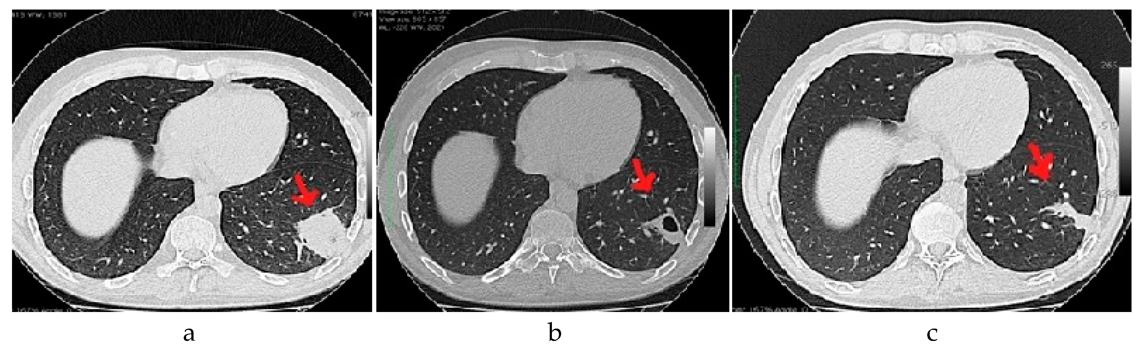 Nutrients 11 00581 g001 Nutrients 11 00581 g001