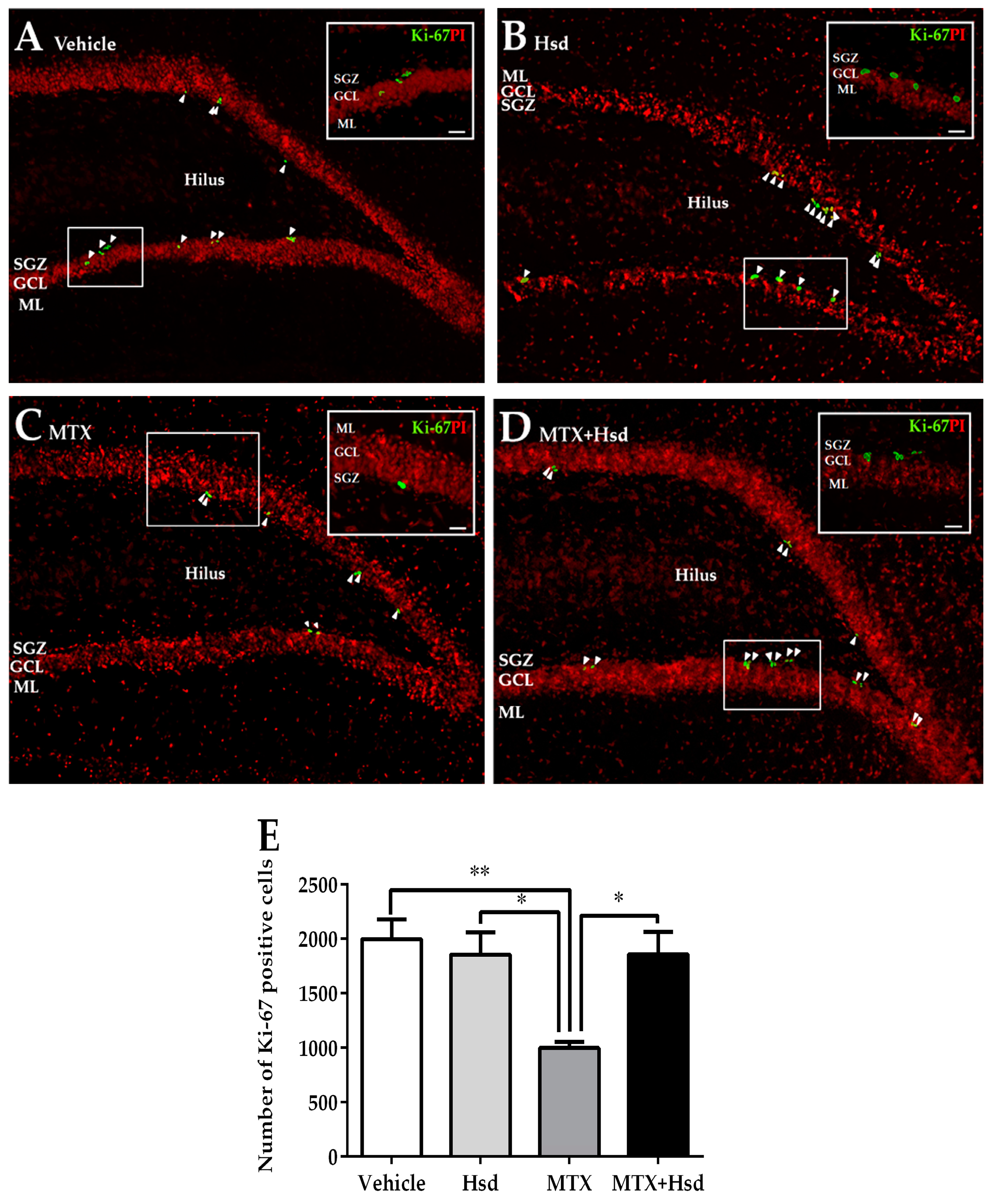 Headers Linked To Memory Deficit In >> Nutrients Free Full Text Hesperidin Alleviates Methotrexate Headers Linked To Memory Deficit In >> Nutrients Free Full Text Hesperidin Alleviates Methotrexate
