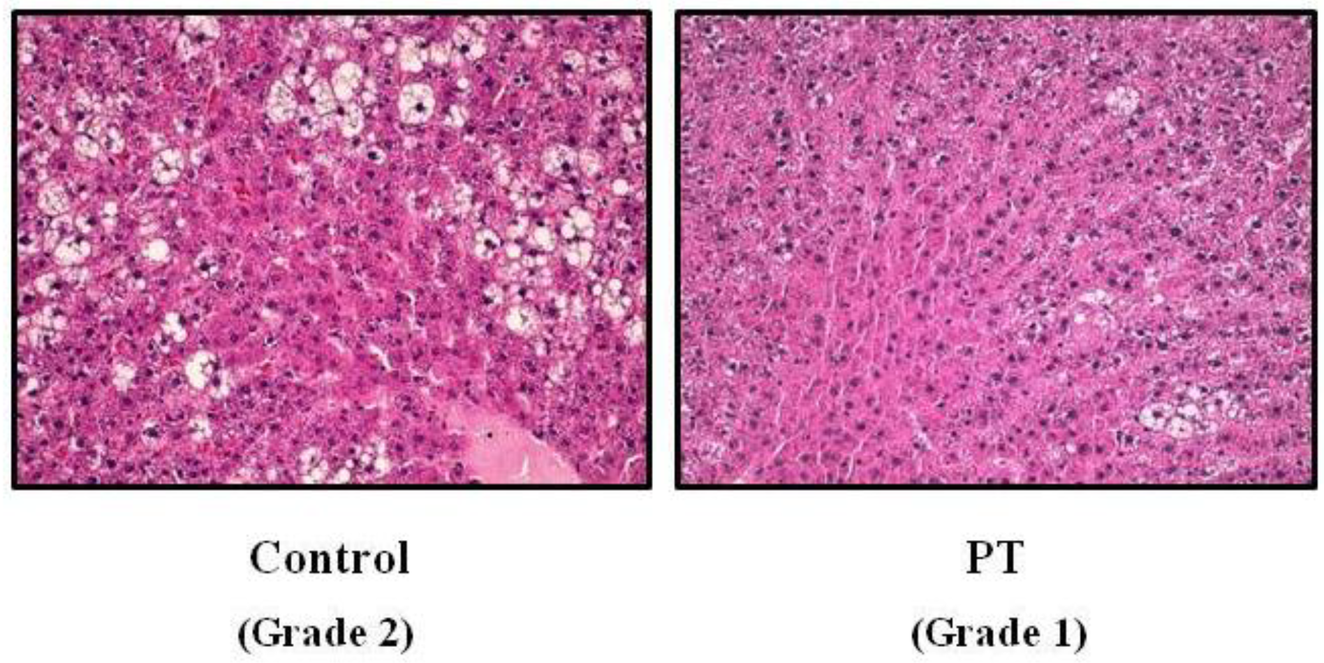 Nutrients 11 00961 g001