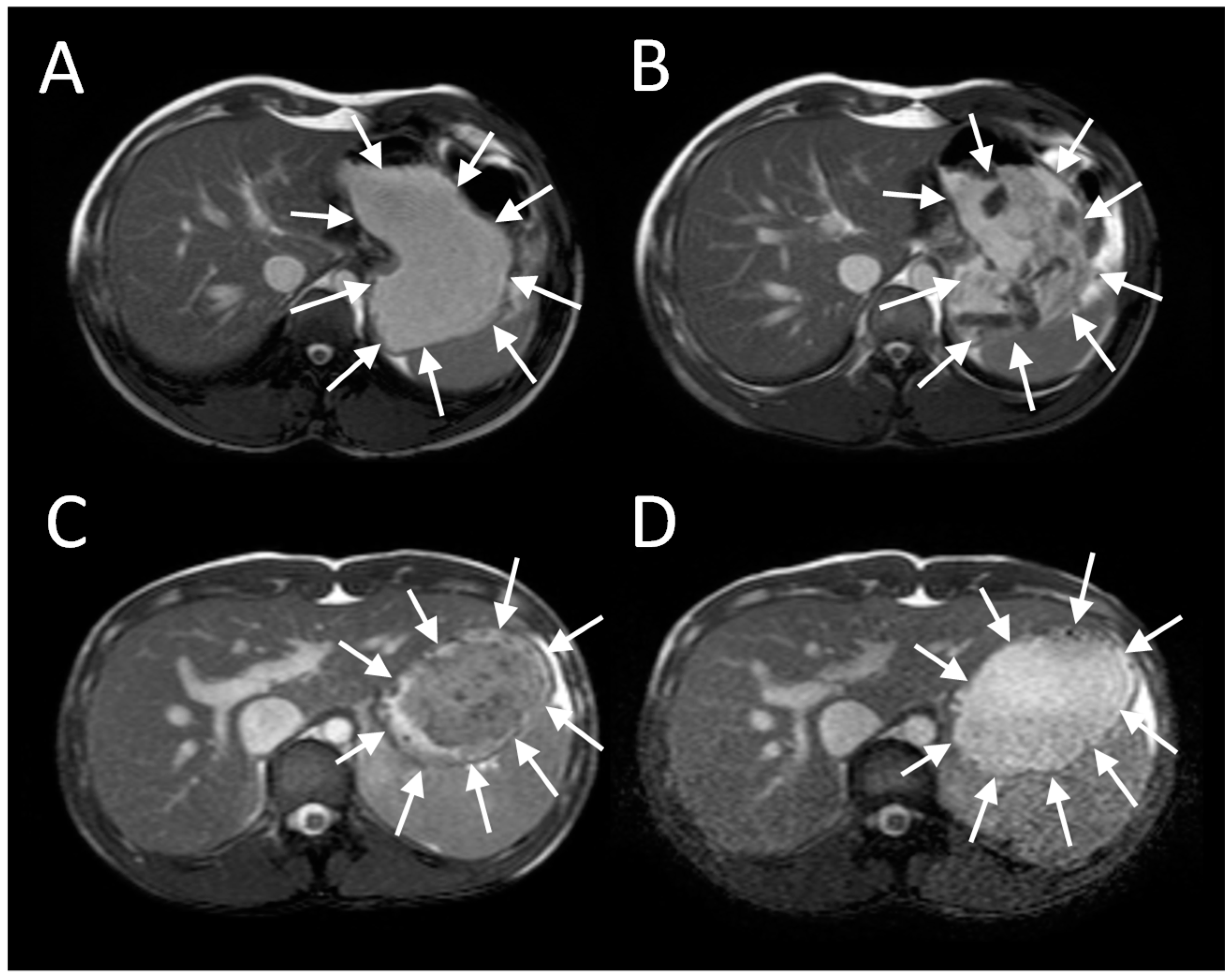 Nutrients 11 01147 g001