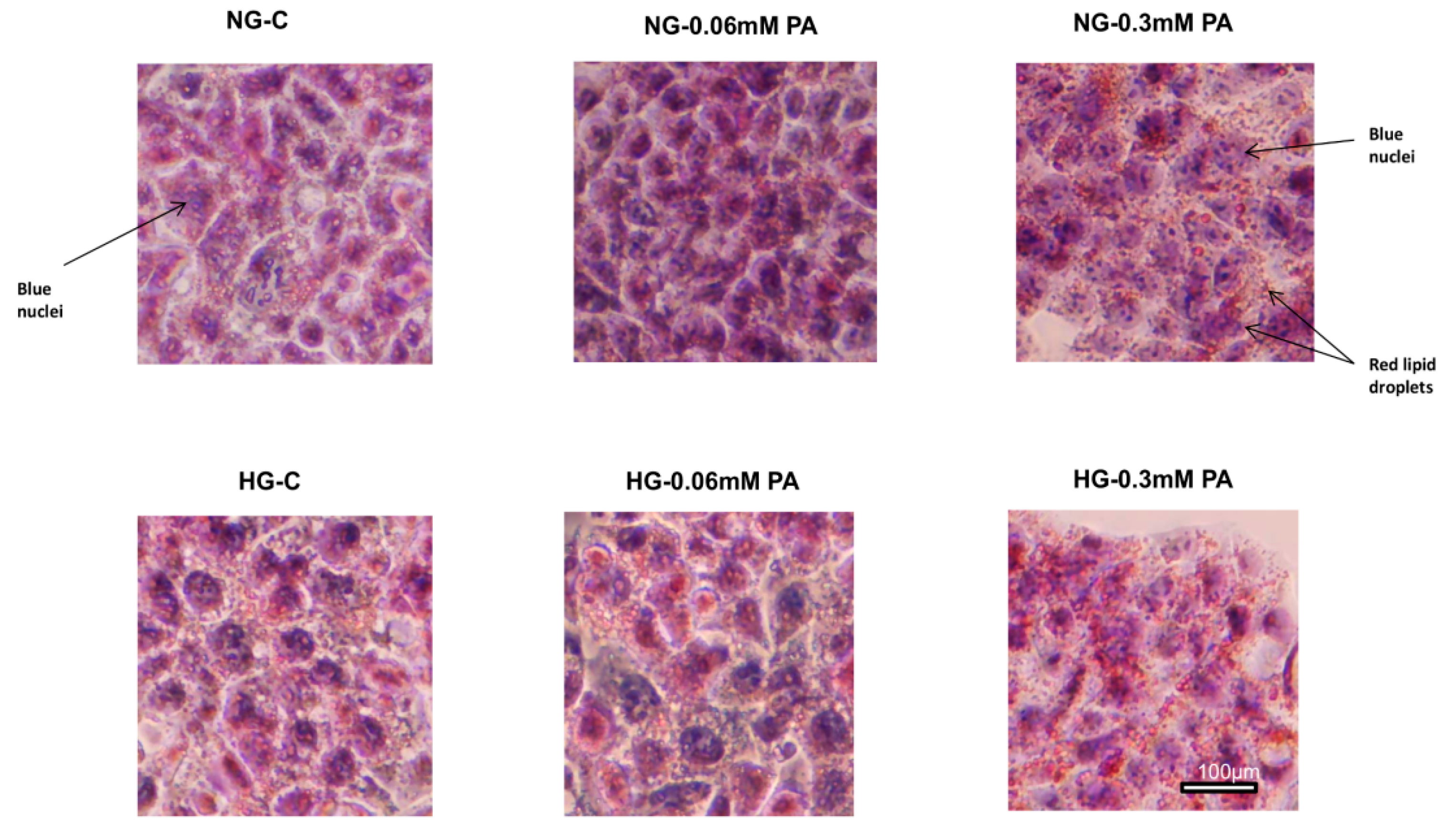 Nutrients Free Full Text Augmentation Of Glucotoxicity Oxidative Stress Apoptosis And Mitochondrial Dysfunction In Hepg2 Cells By Palmitic Acid Html