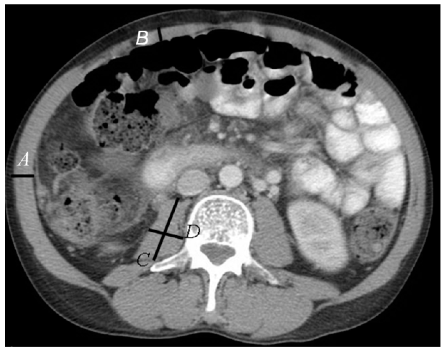 Nutrients 11 02097 g002