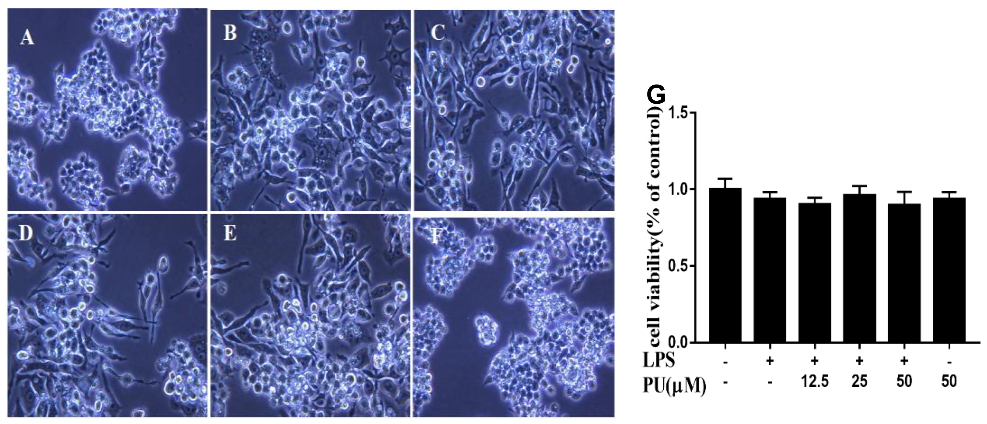 Nutrients Free Full Text Punicalagin Prevents Inflammation In Lps Induced Raw264 7 Macrophages By Inhibiting Foxo3a Autophagy Signaling Pathway Html