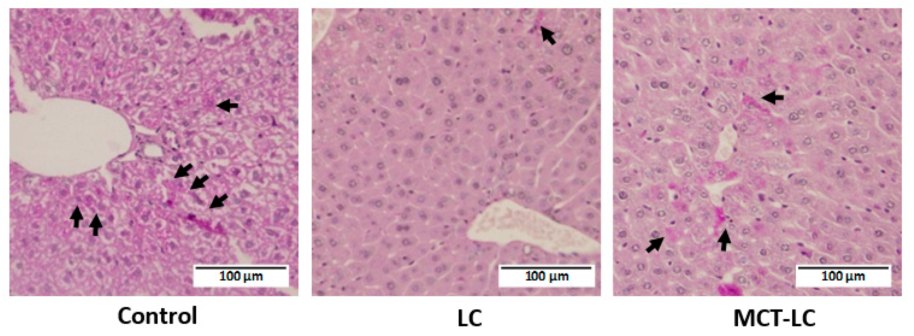 Nutrients 11 02801 g006