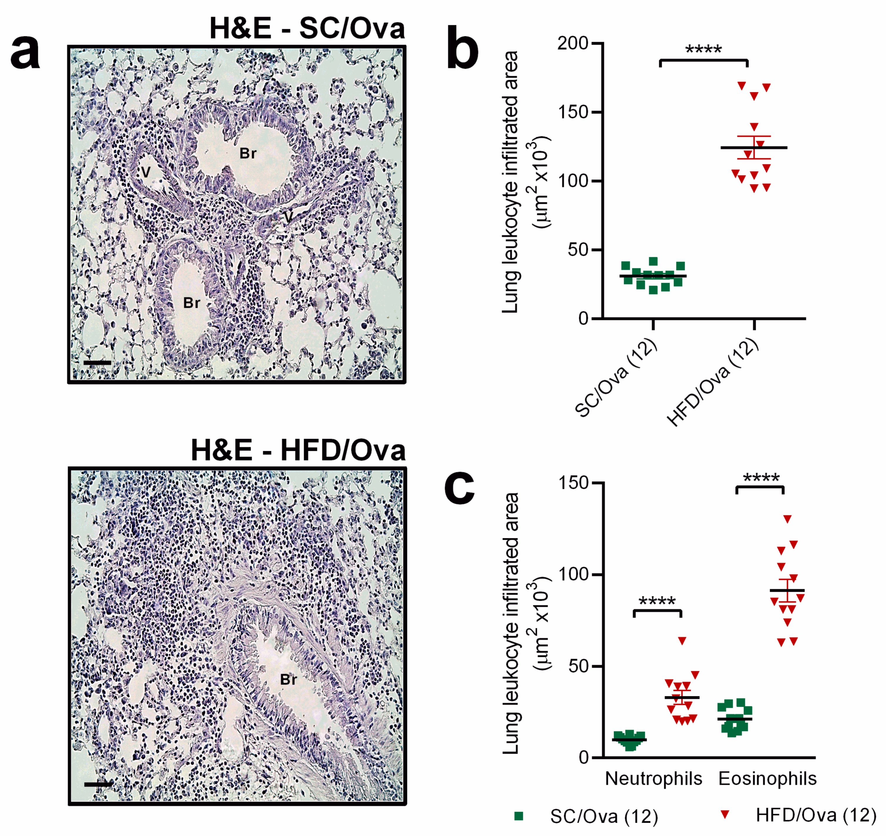 Nutrients Free Full Text Maternal Obesity In Mice Exacerbates The Allergic Inflammatory Response In The Airways Of Male Offspring Html Nutrients Free Full Text Maternal Obesity In Mice Exacerbates The Allergic Inflammatory Response In The Airways Of Male Offspring Html