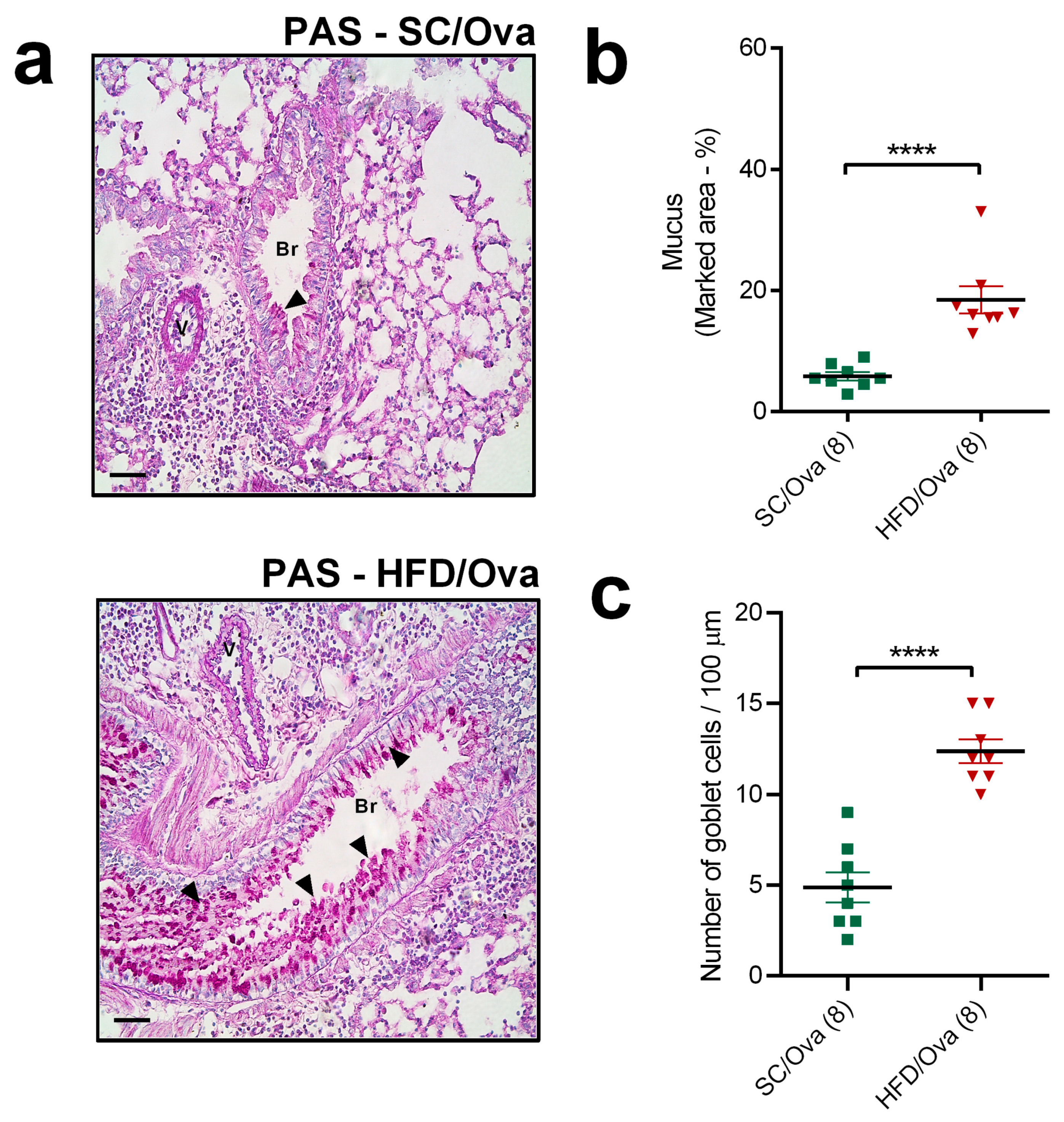 Nutrients Free Full Text Maternal Obesity In Mice Exacerbates The Allergic Inflammatory Response In The Airways Of Male Offspring Html Nutrients Free Full Text Maternal Obesity In Mice Exacerbates The Allergic Inflammatory Response In The Airways Of Male Offspring Html