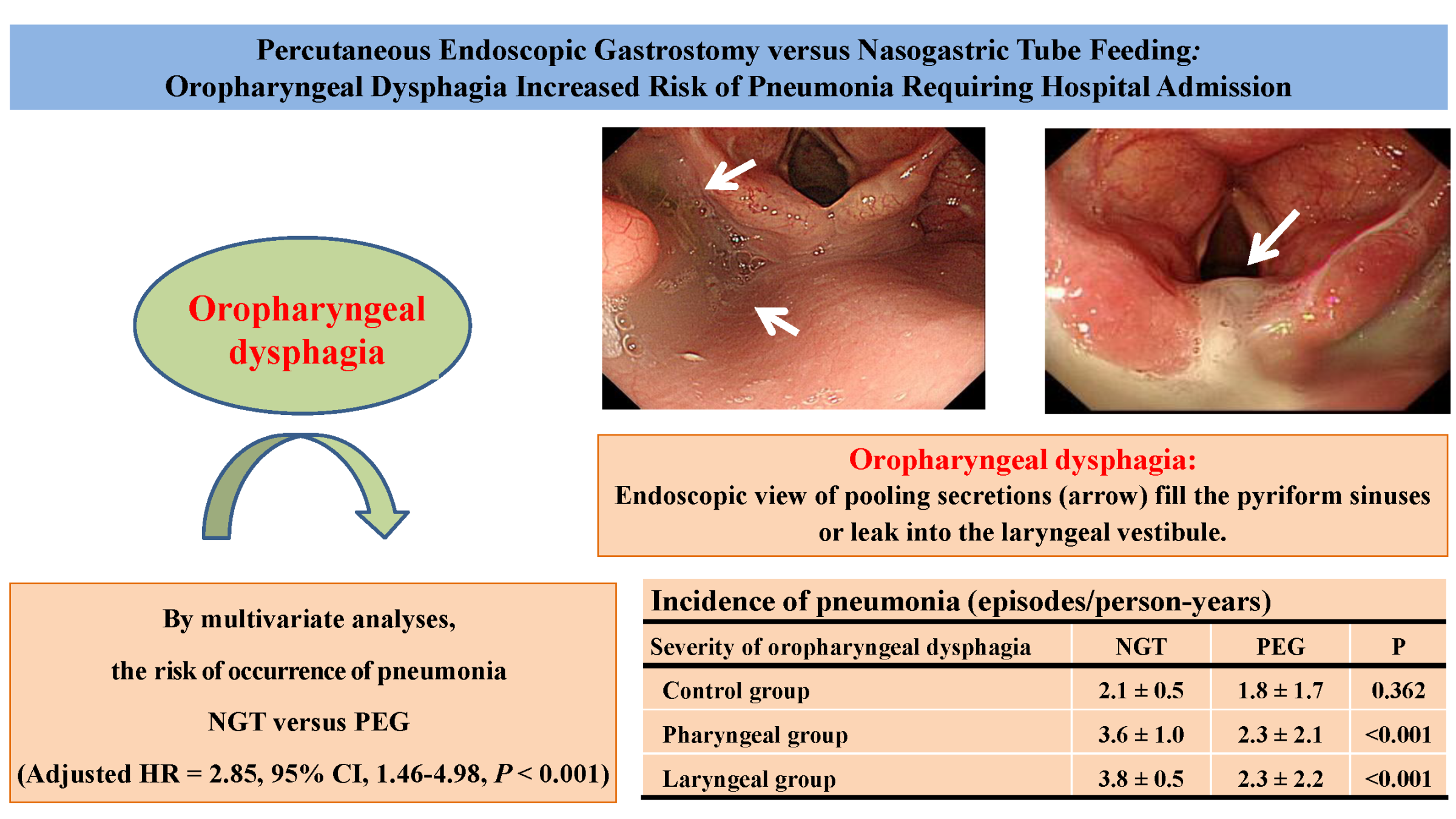 Nutrients Free FullText Percutaneous Endoscopic Gastrostomy versus