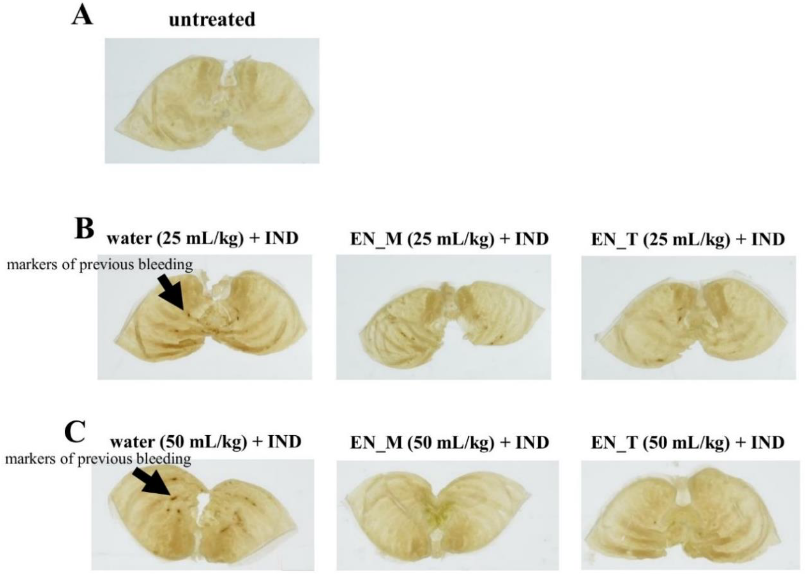 Nutrients 11 03058 g003 Nutrients 11 03058 g003