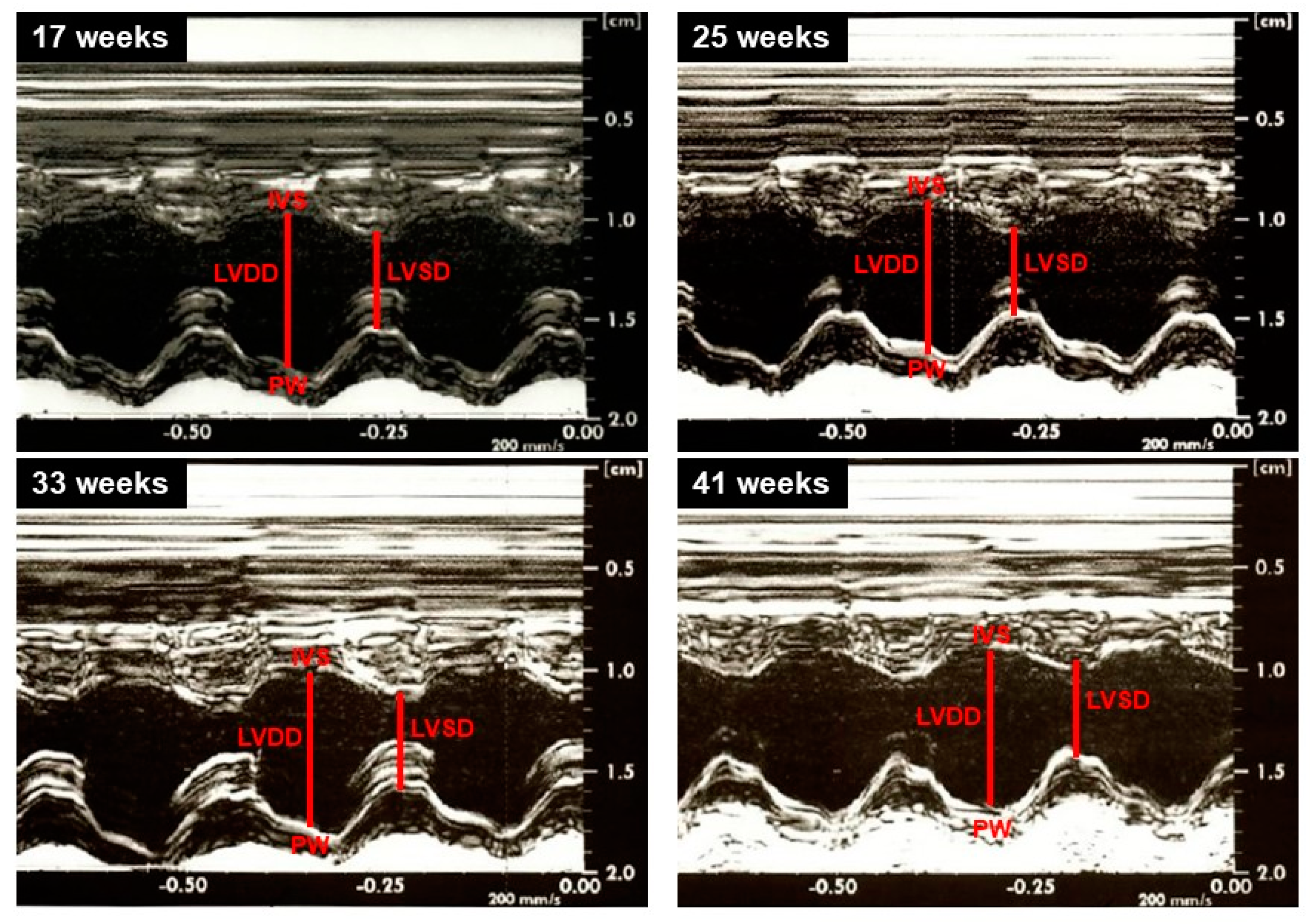 Nutrients 12 00068 g005 Nutrients 12 00068 g005