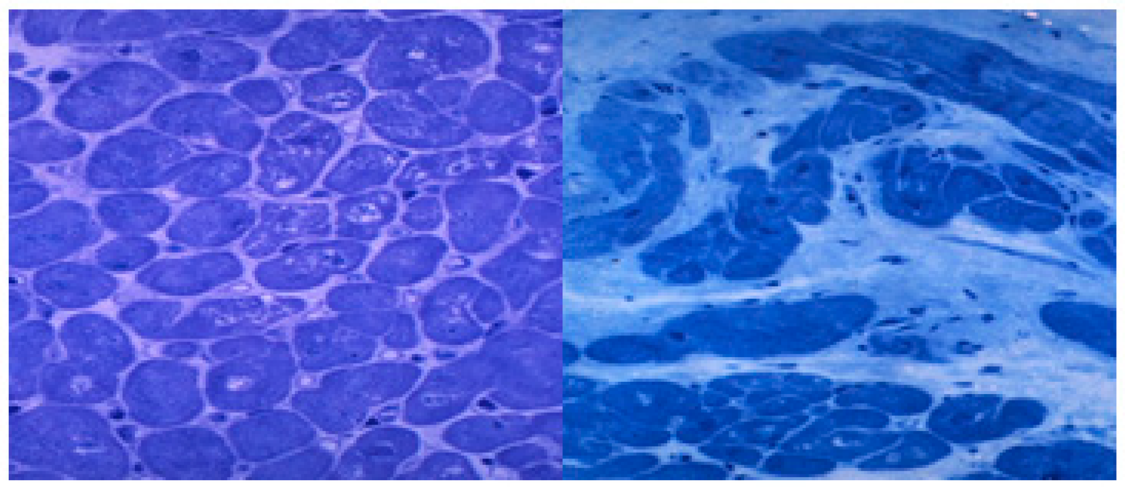 Nutrients 12 00572 g002 Nutrients 12 00572 g002