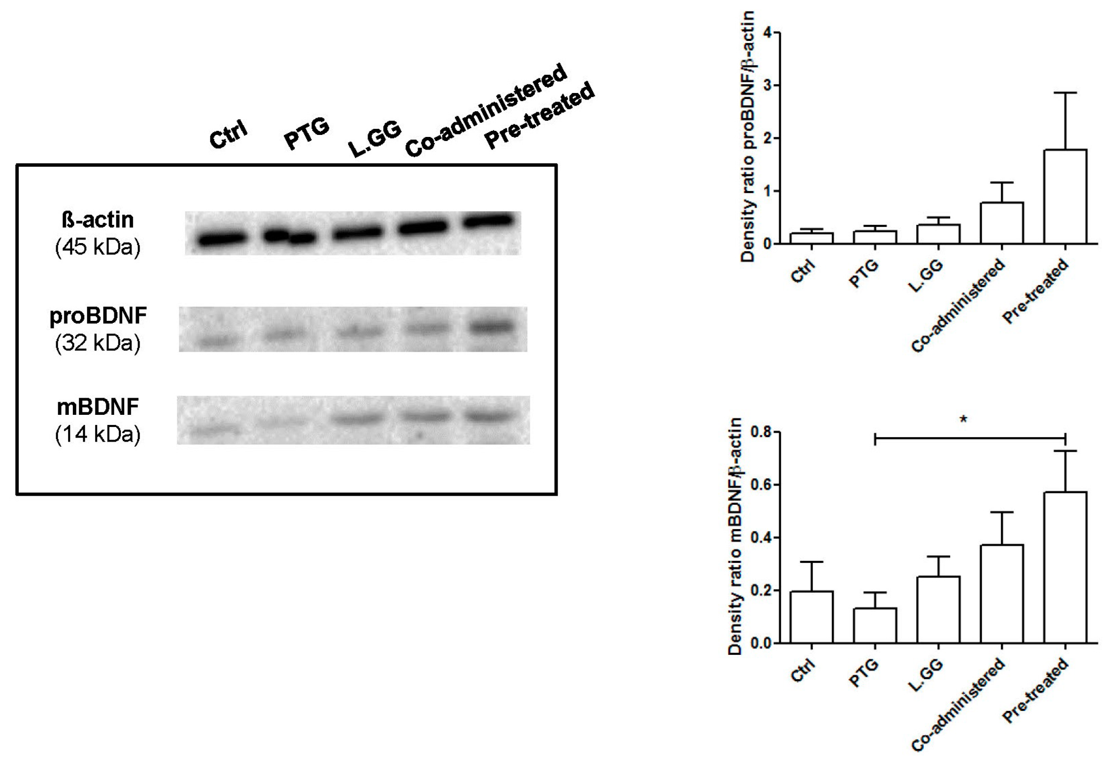 Action ACTINA NEVADA W7H SERIES Driver Download For Windows Action ACTINA NEVADA W7H SERIES Driver Download For Windows