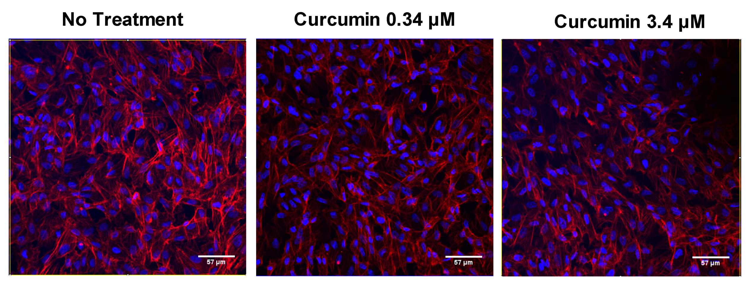 Nutrients 12 00879 g003 Nutrients 12 00879 g003