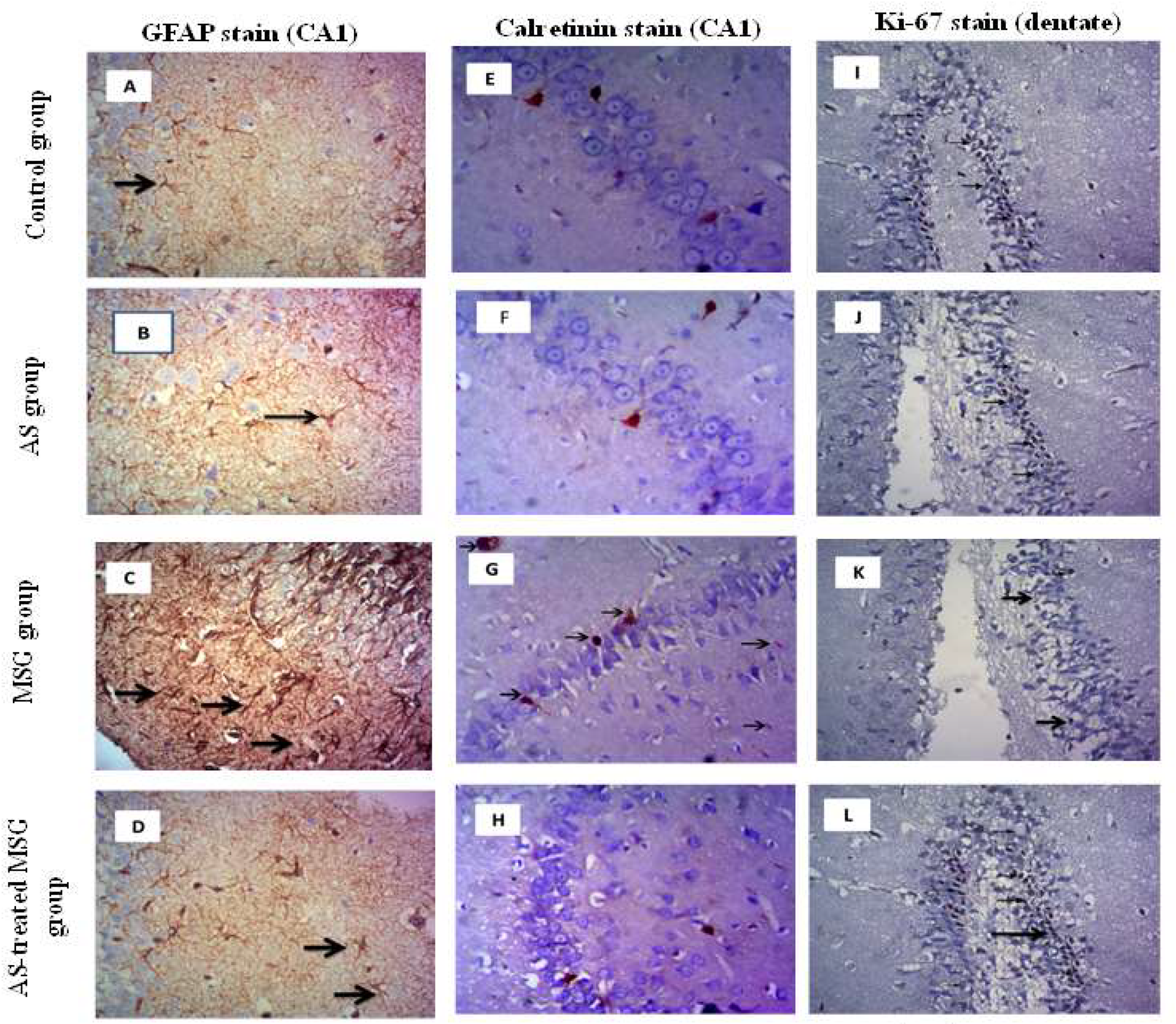 Nutrients 12 01028 g006a Nutrients 12 01028 g006a