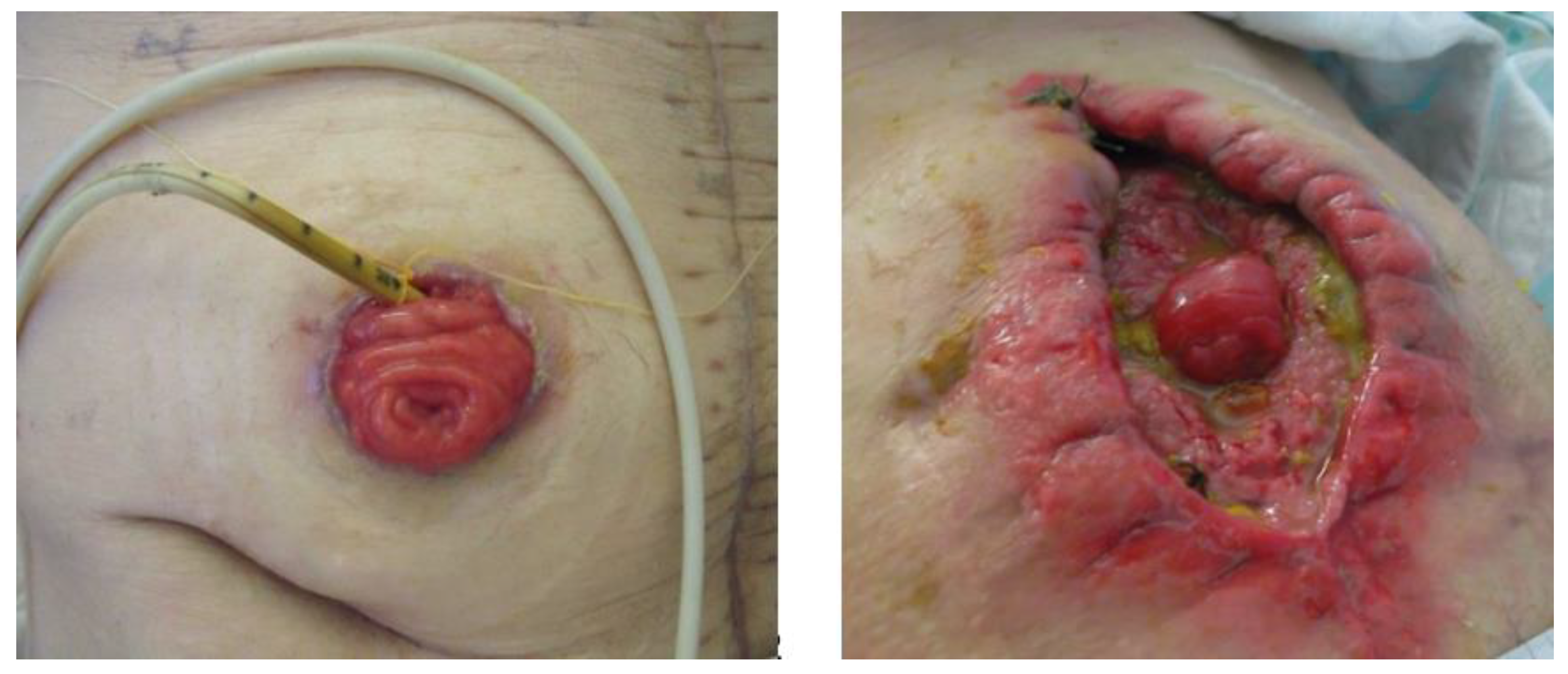 Nutrients 12 01376 g001