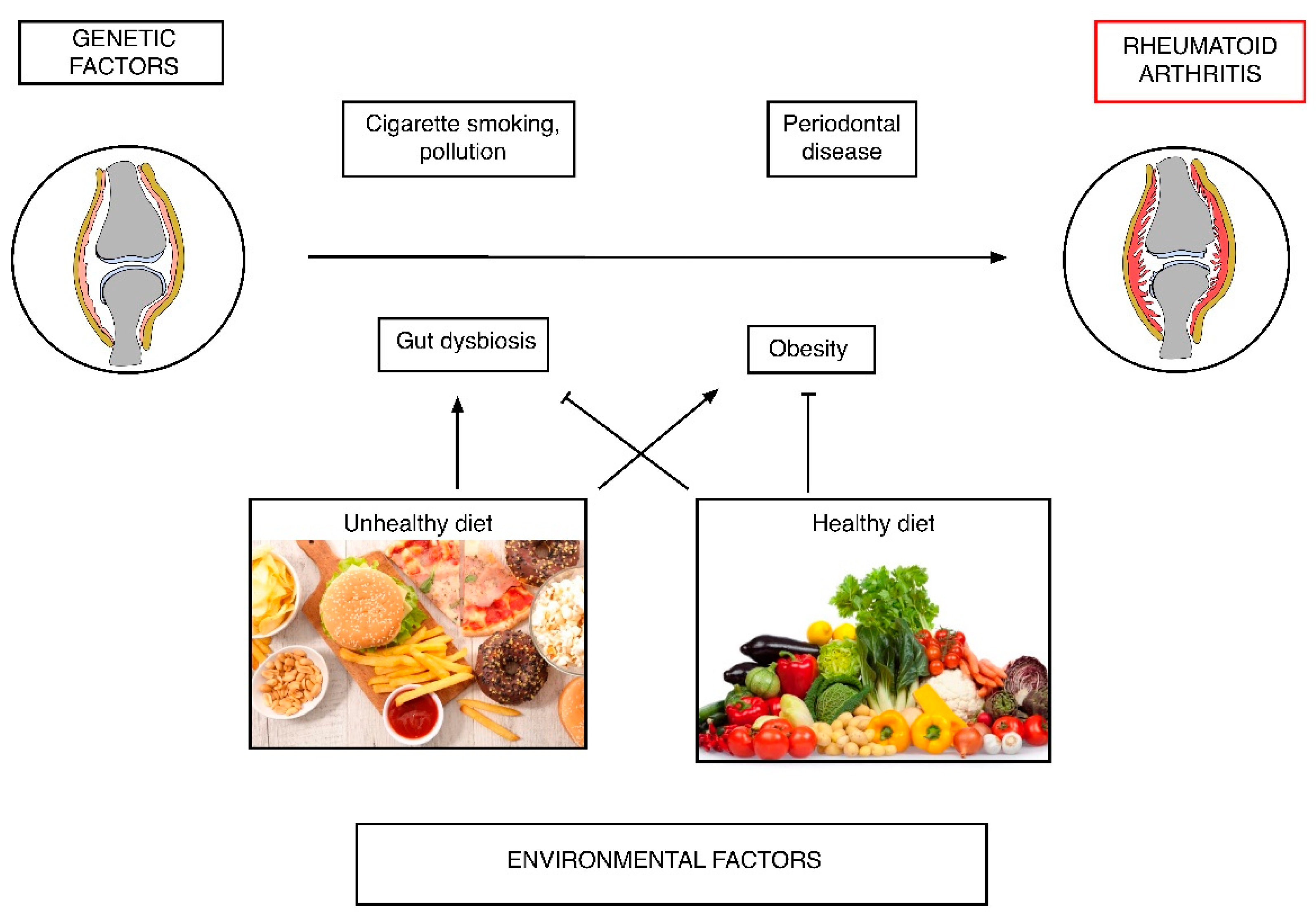 rheumatoid arthritis diet keto