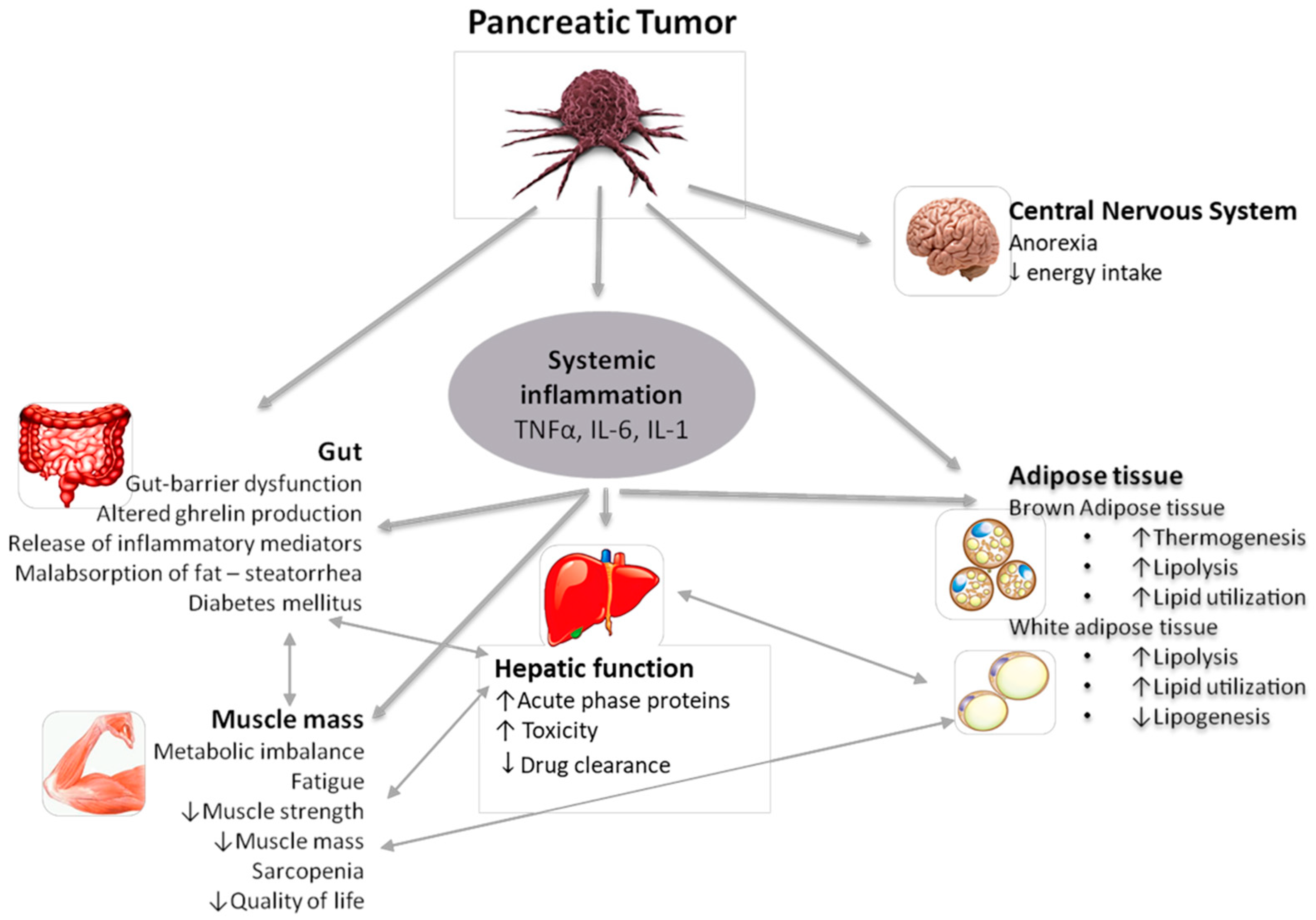Tumor neuroendocrino páncreas esperanza de vida