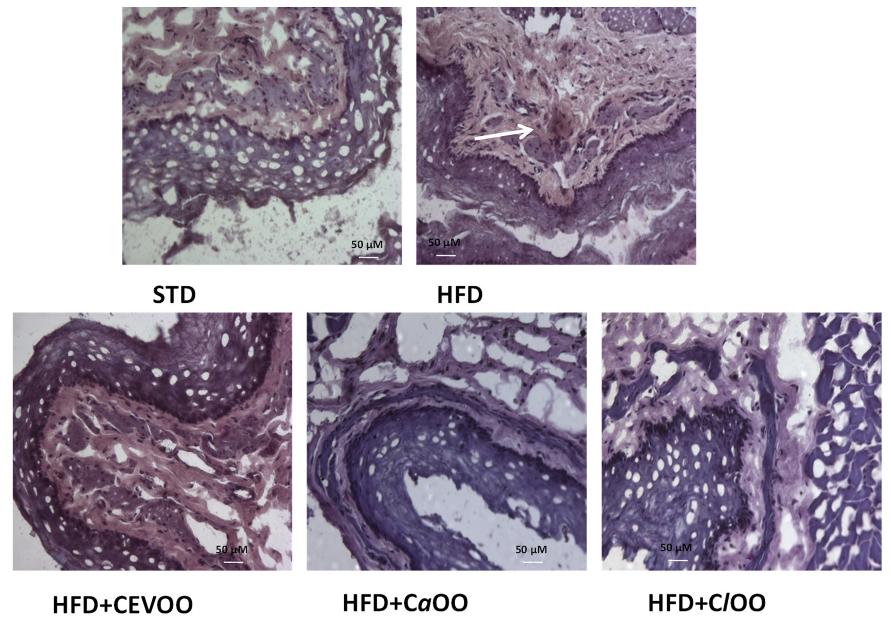 Nutrients 12 01557 g012 Nutrients 12 01557 g012