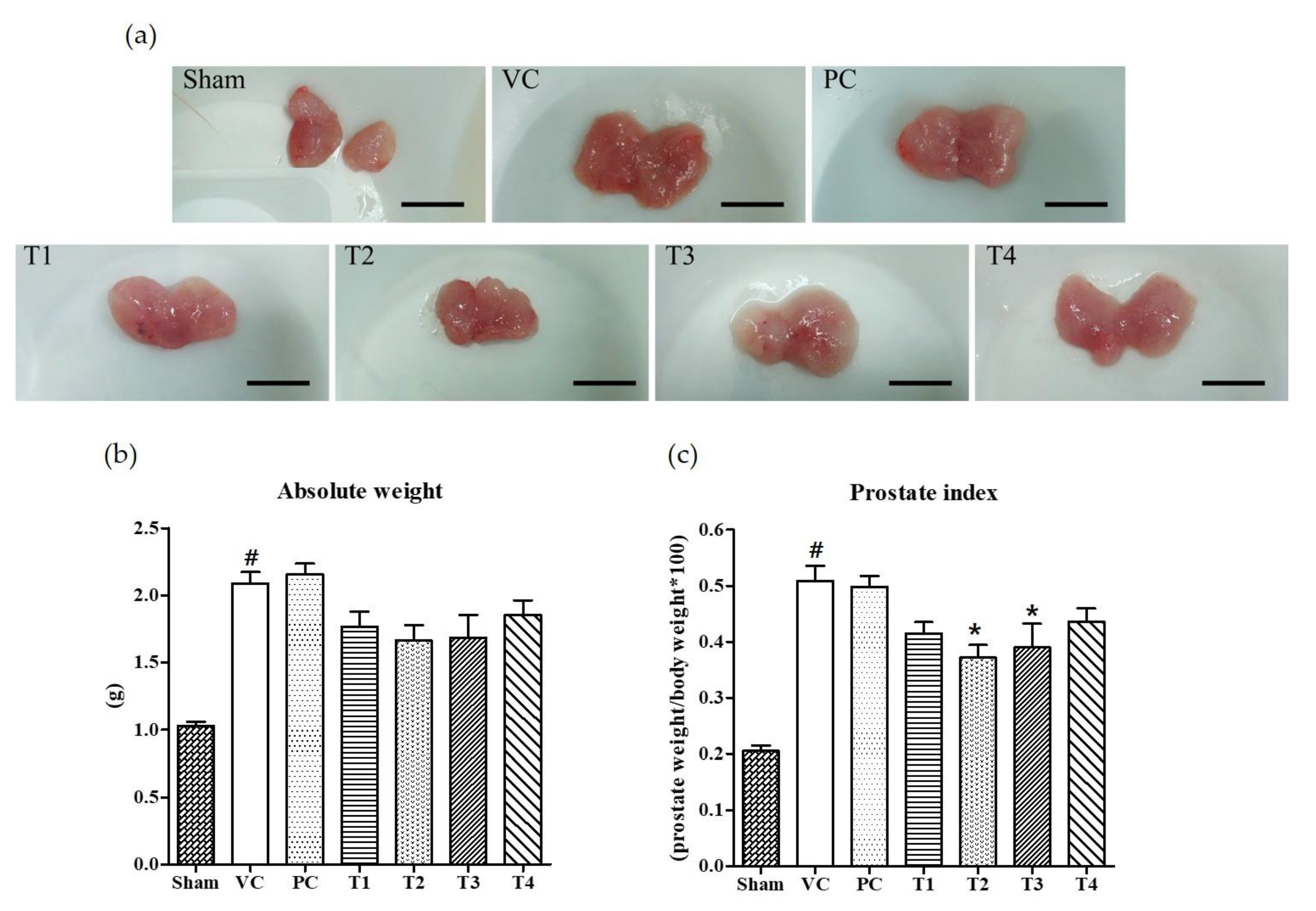 prostatitis és pcr)