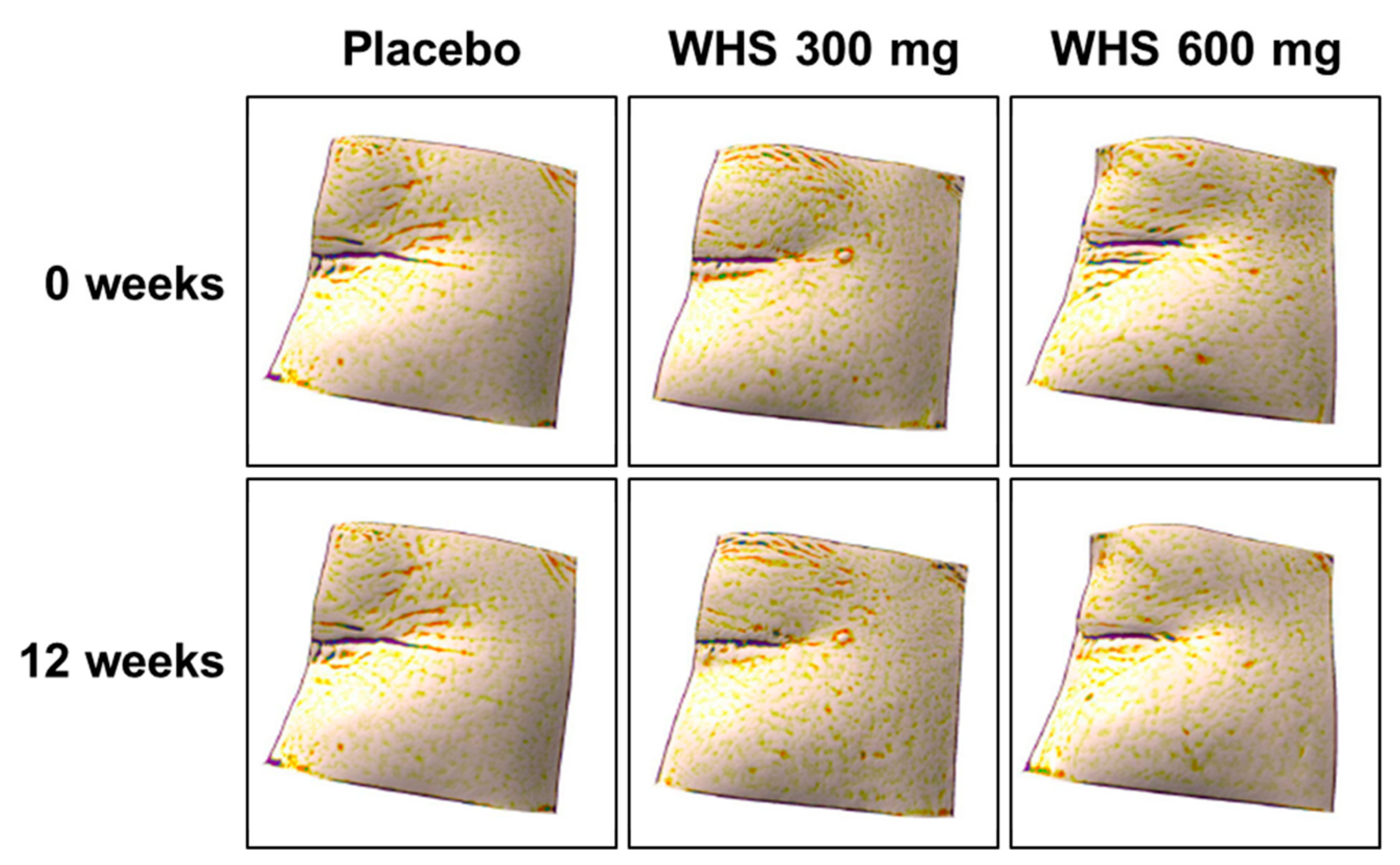 Nutrients 12 01588 g003