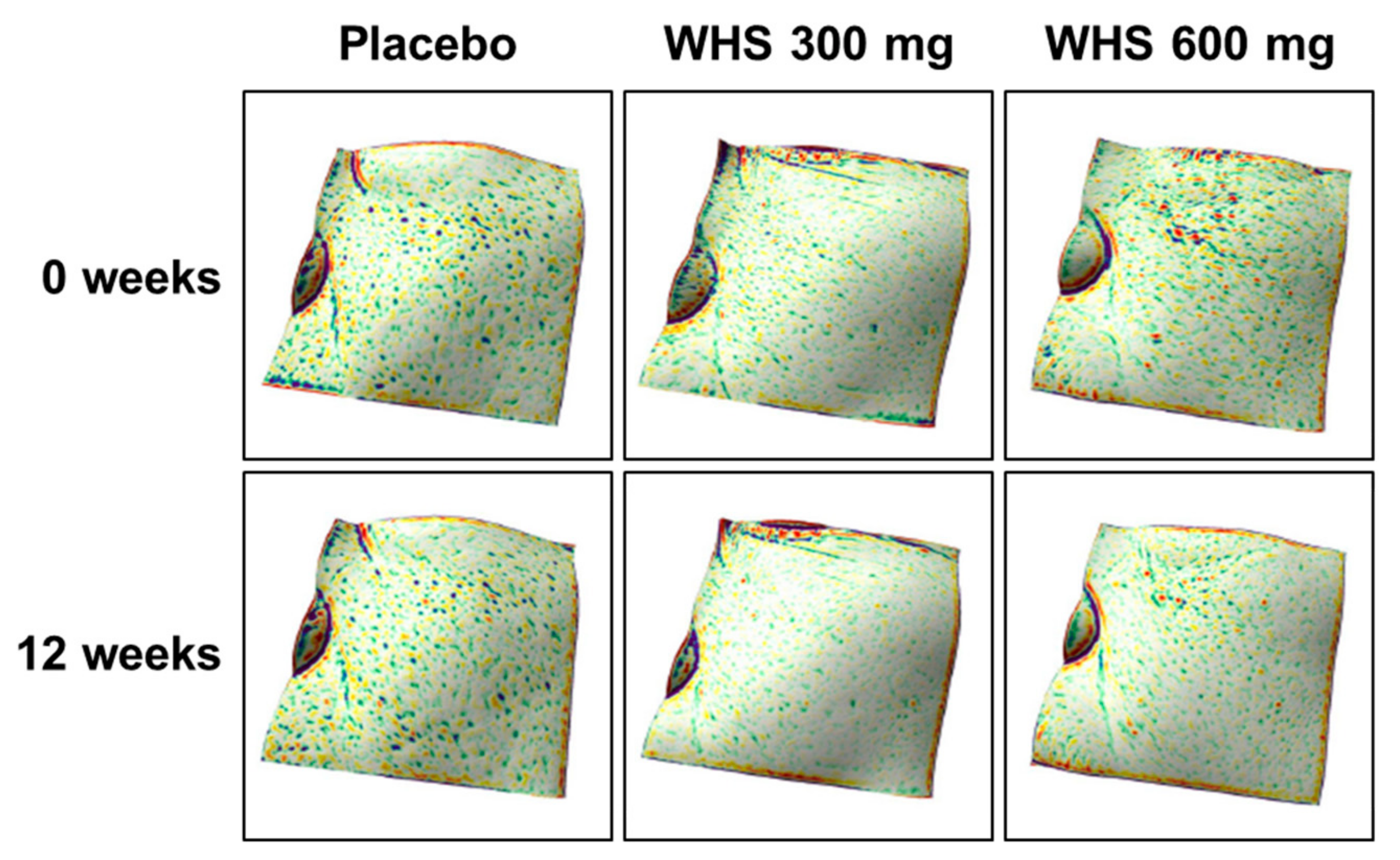 Nutrients 12 01588 g006