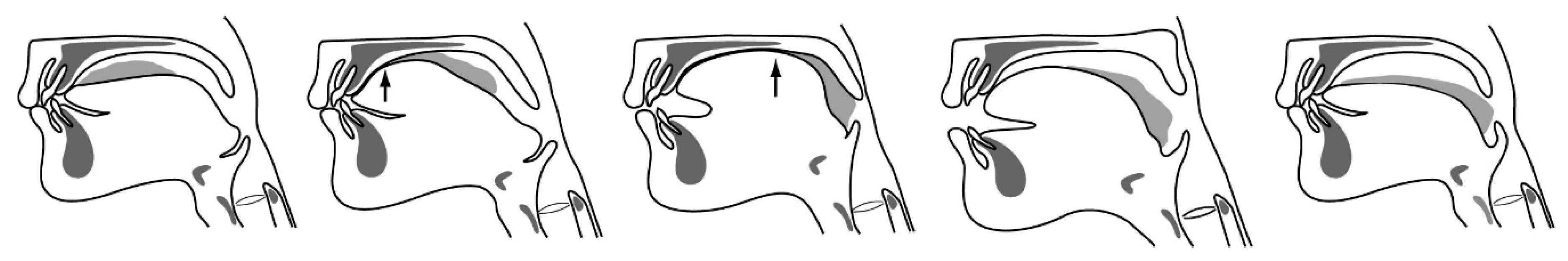 Nutrients 12 01613 g003 Nutrients 12 01613 g003