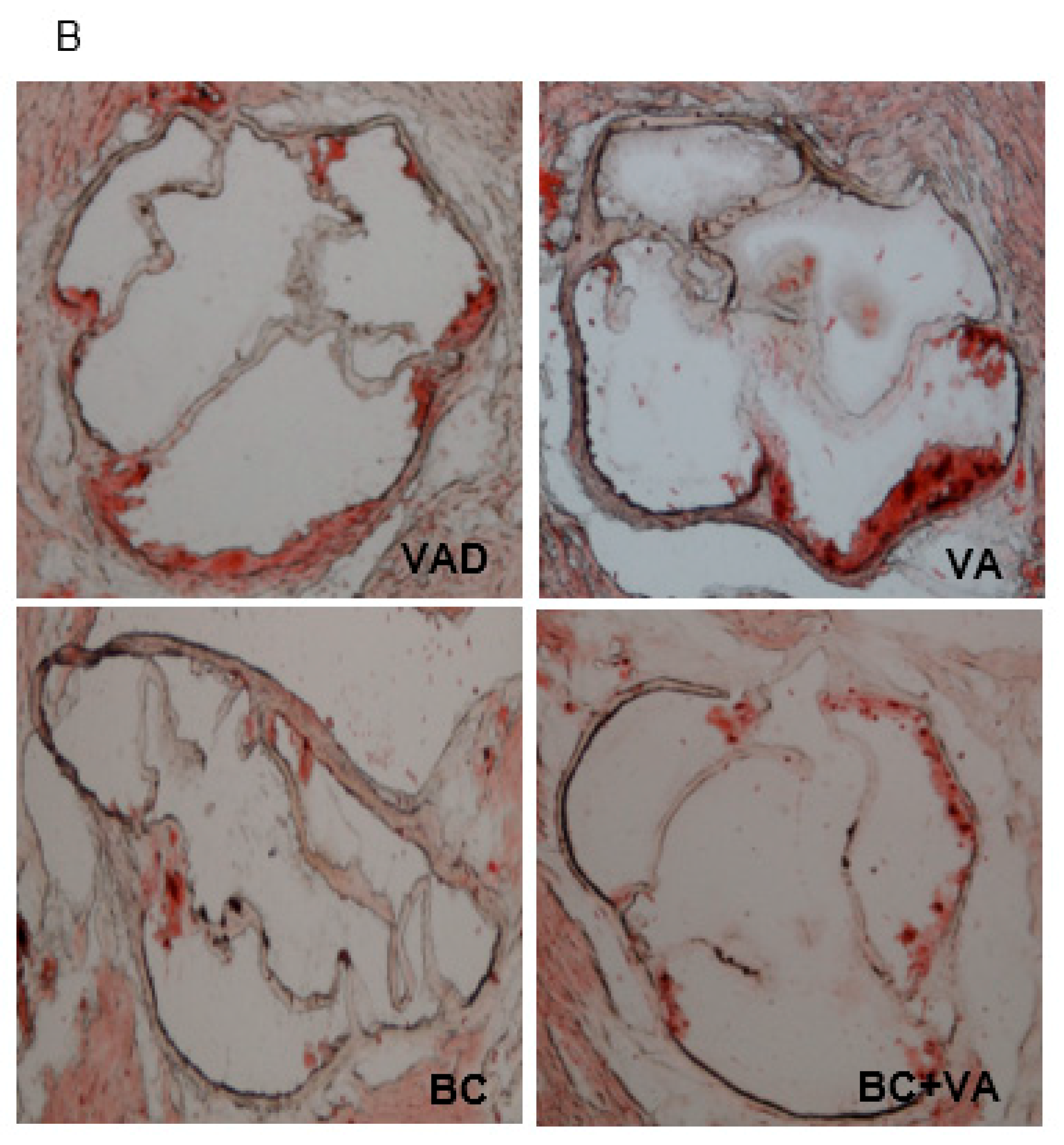 Nutrients 12 01625 g004b Nutrients 12 01625 g004b