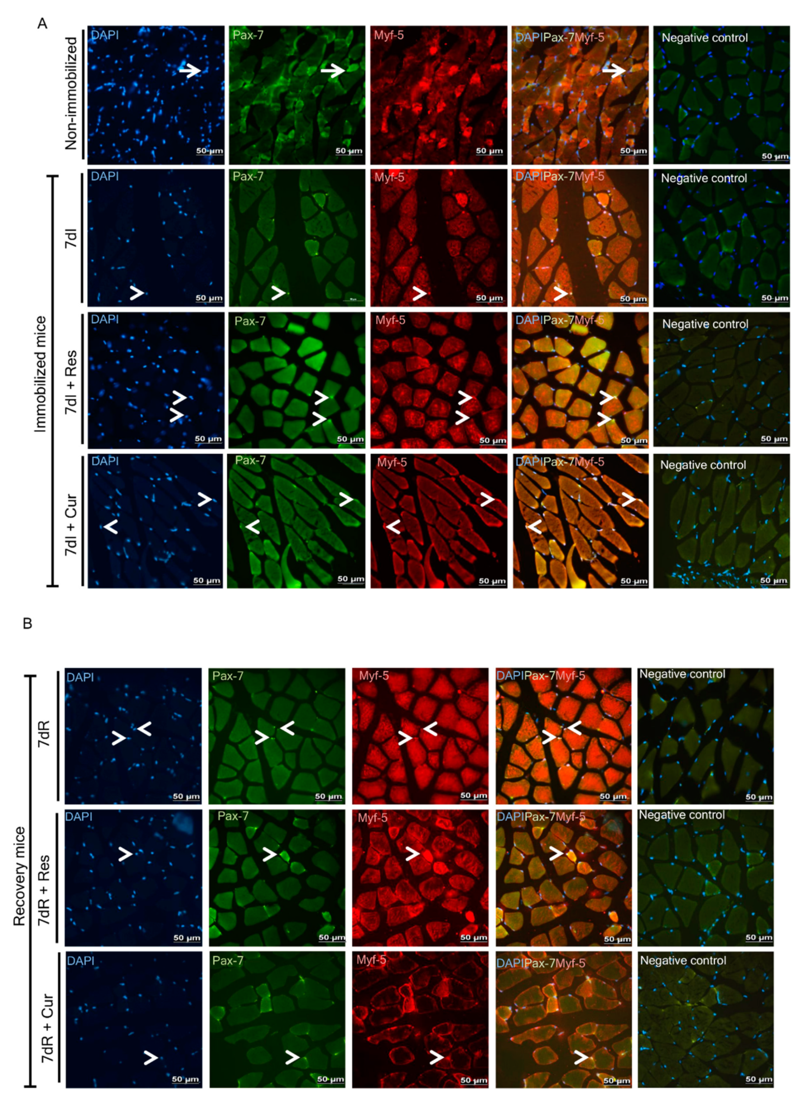 Nutrients 12 01870 g005 Nutrients 12 01870 g005