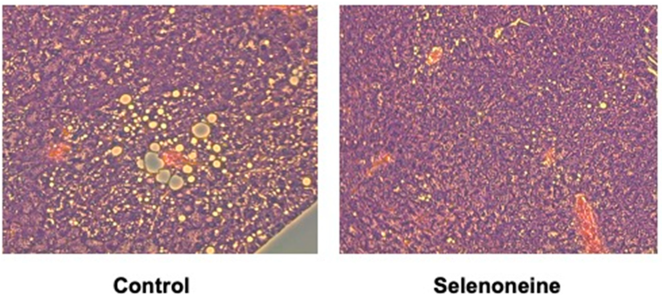 Nutrients 12 01898 g006 Nutrients 12 01898 g006